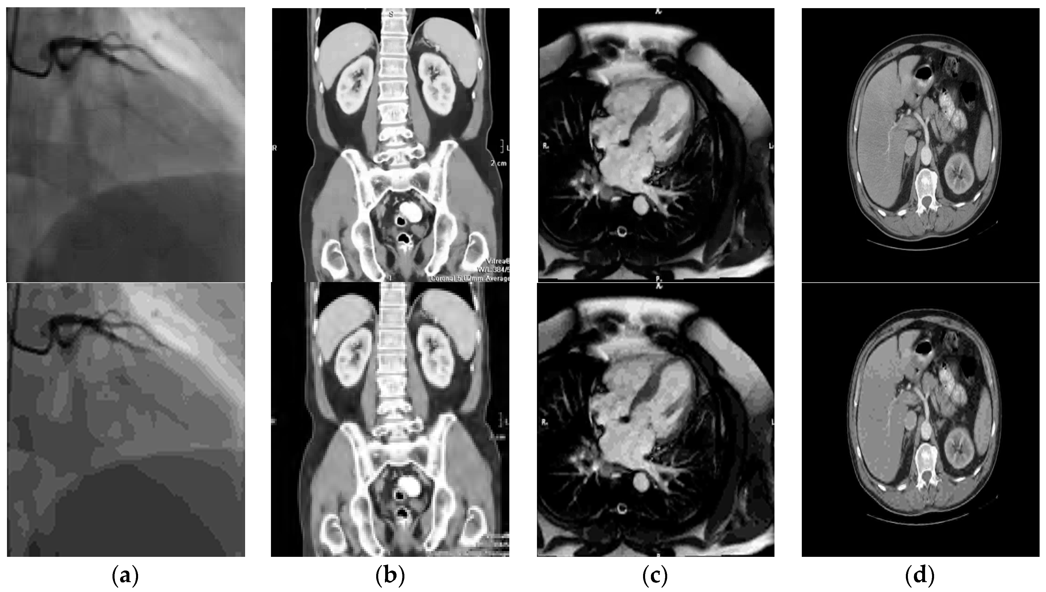 Electronics 08 00088 g010 Electronics 08 00088 g010