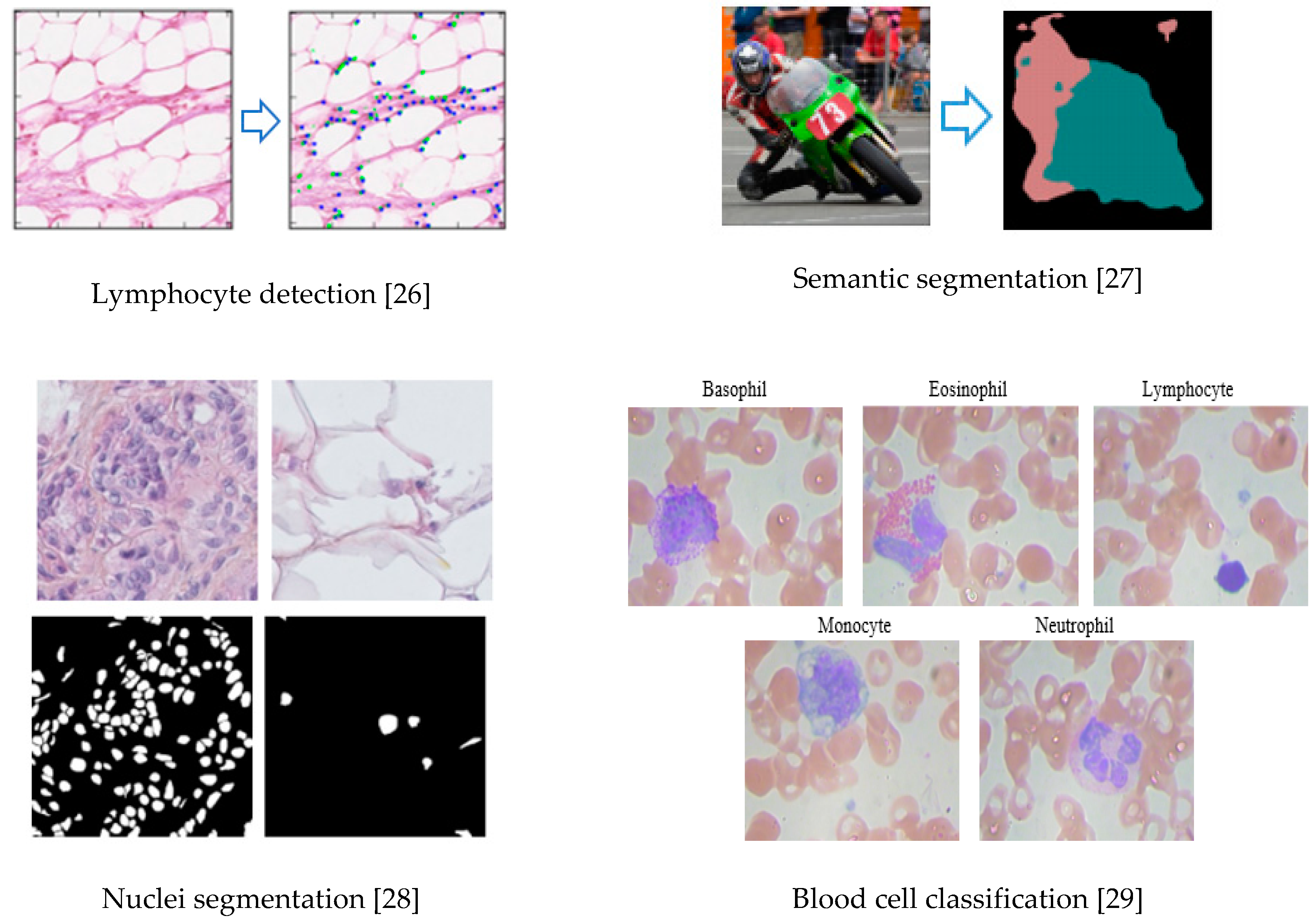 Electronics 08 00292 g006
