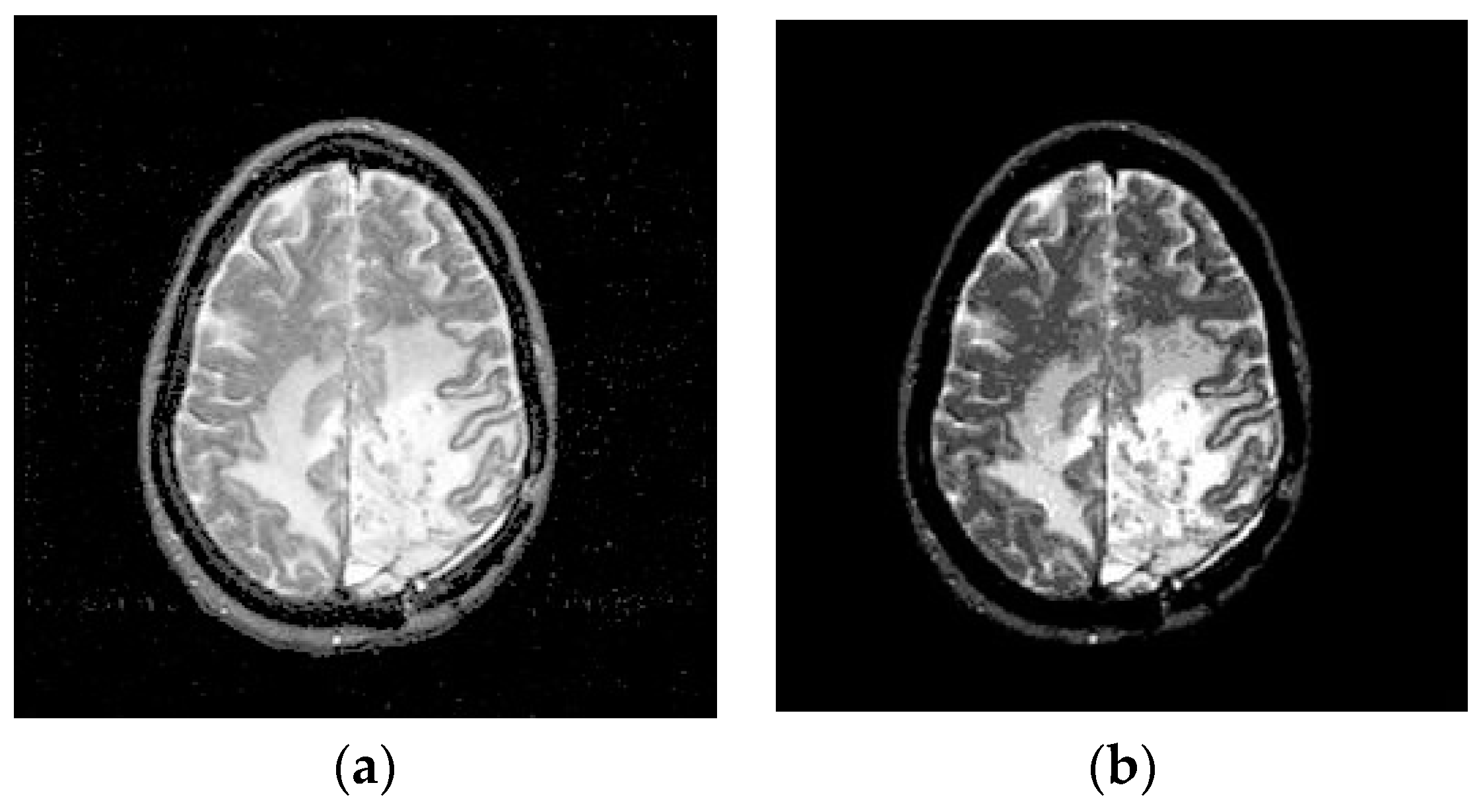 Electronics 08 00975 g003