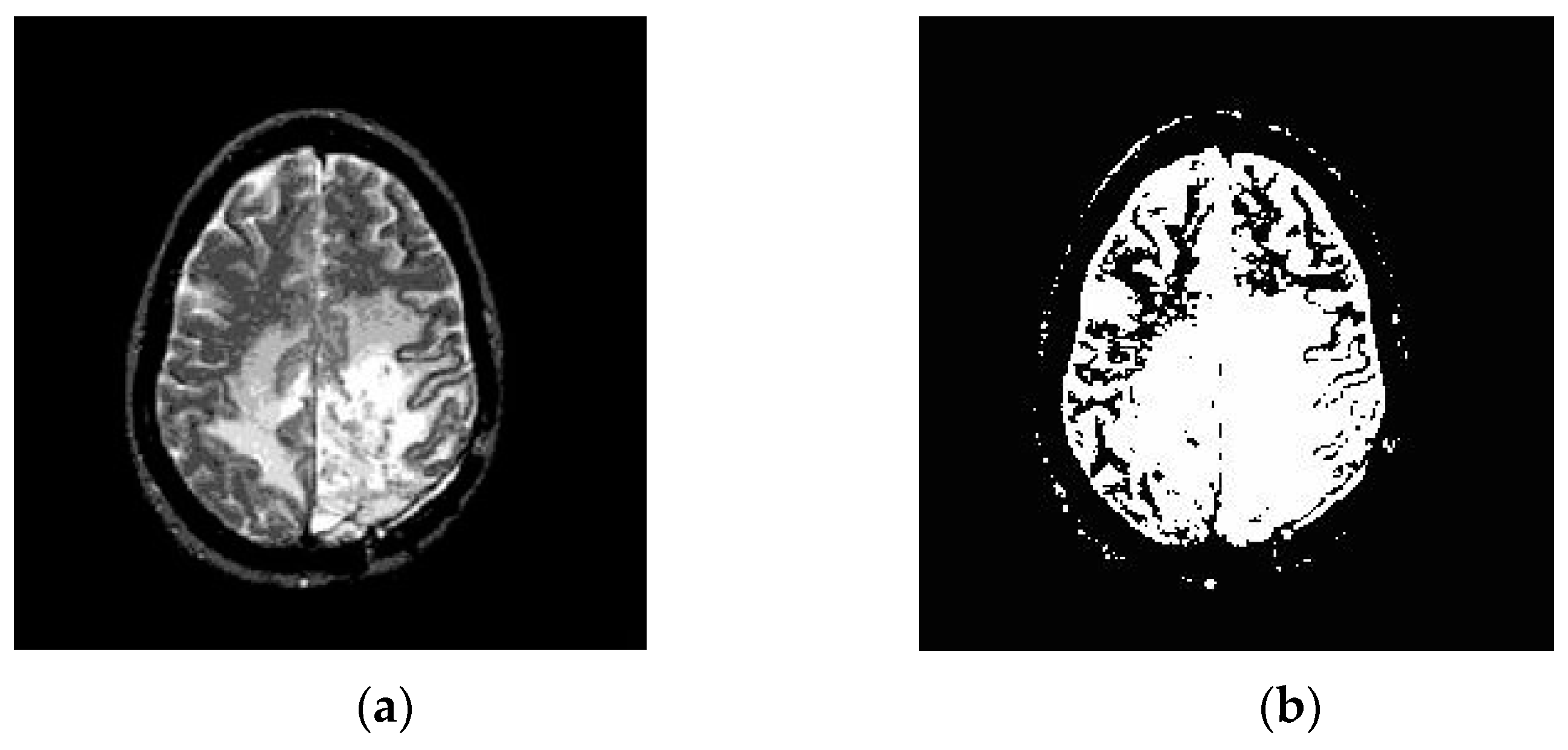 Electronics 08 00975 g005