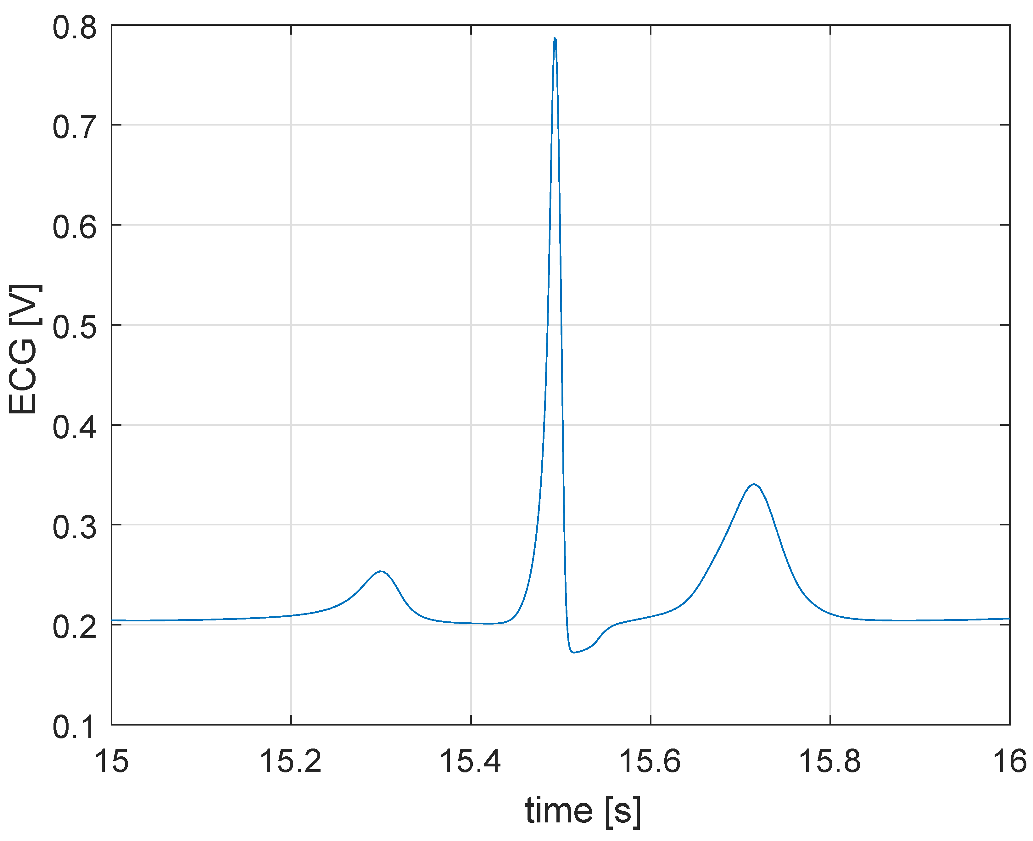 Electronics 09 00571 g005