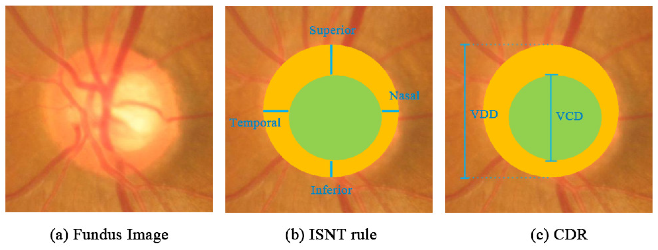 Electronics 09 00909 g009