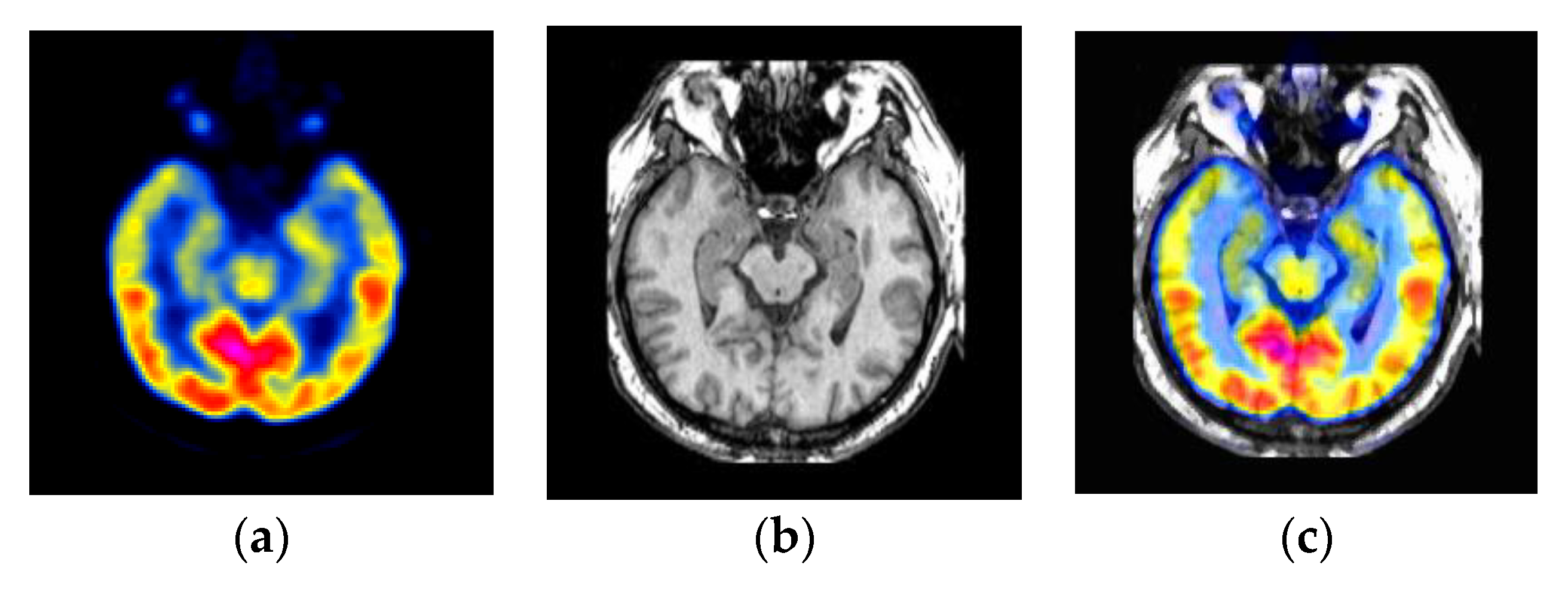 Electronics 09 02162 g006