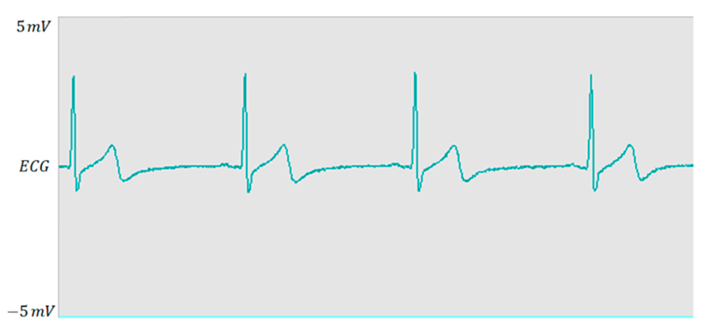 Electronics 10 00359 g011