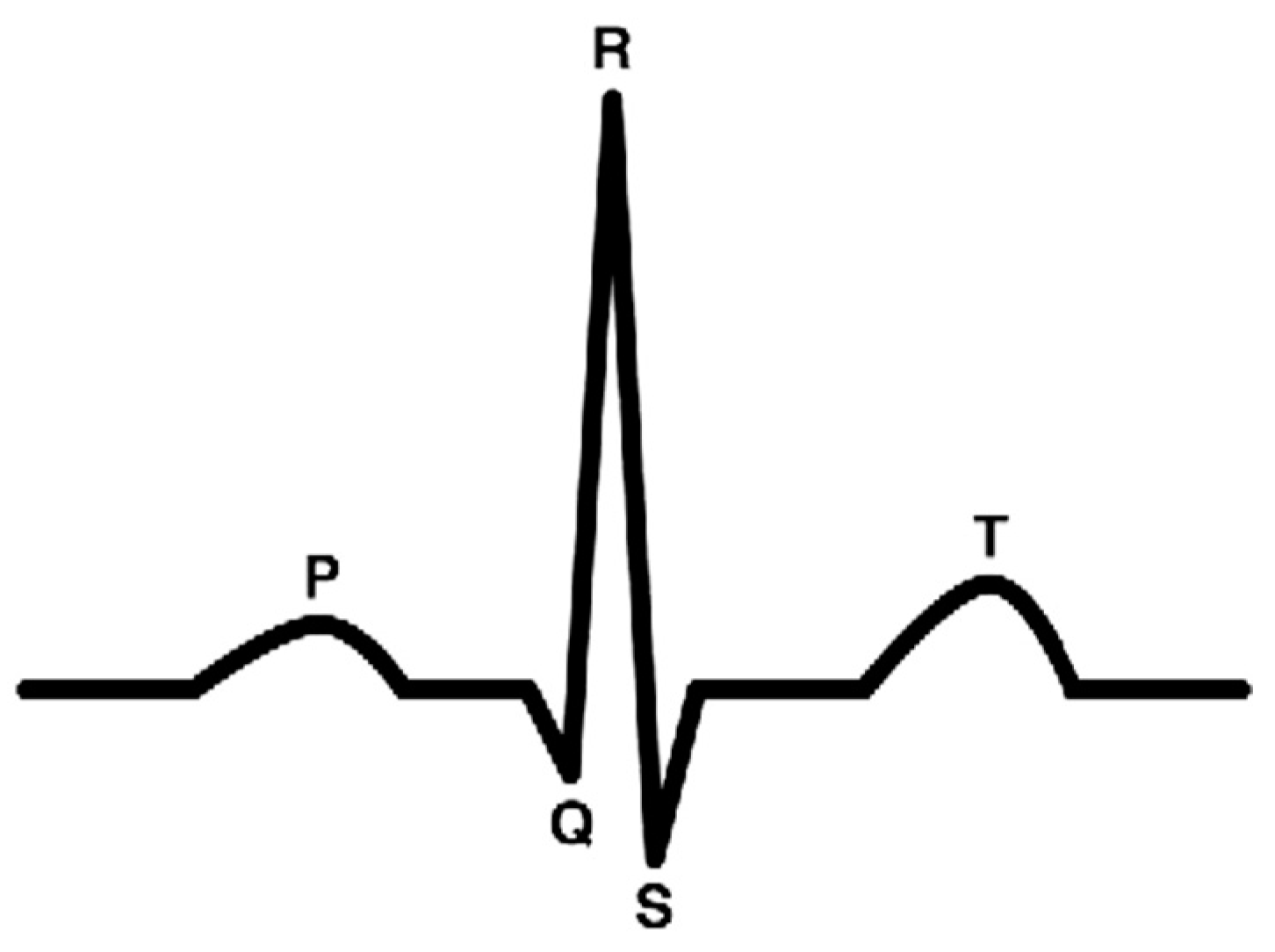 Electronics 10 00404 g002