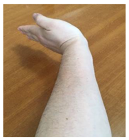 Electronics 10 00923 i005