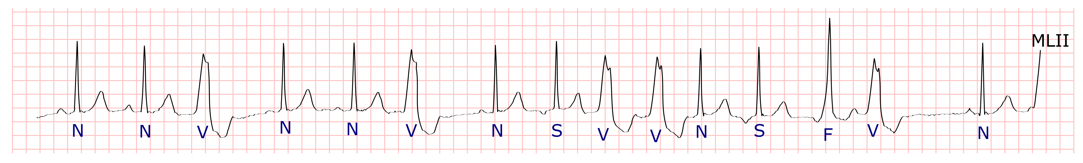 Electronics 10 00976 g001
