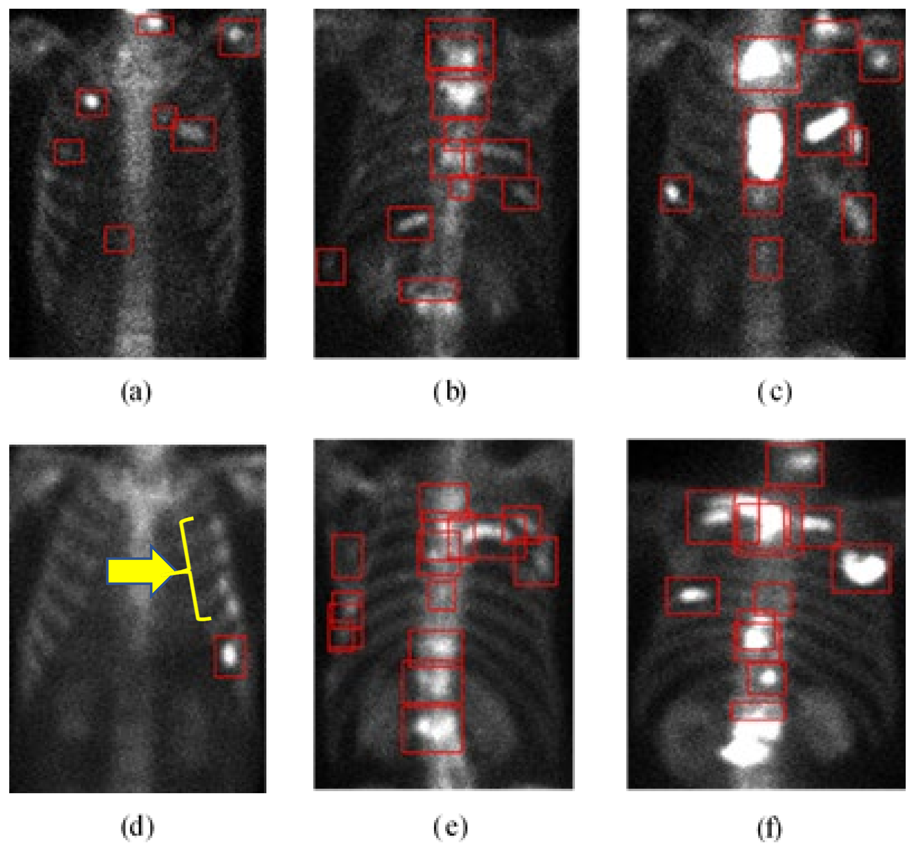 Electronics 10 01201 g006