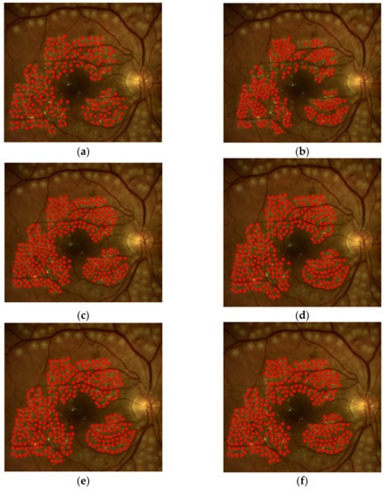Electronics 10 01420 g007