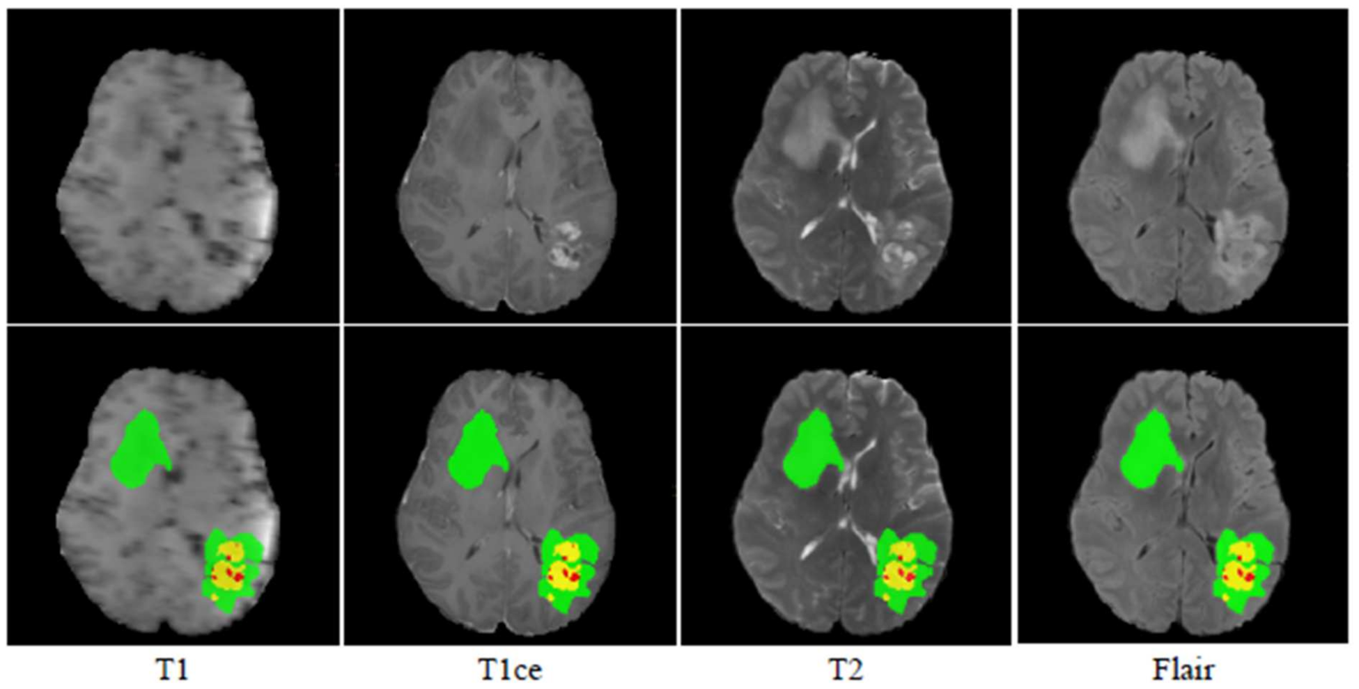 Electronics 10 01962 g004