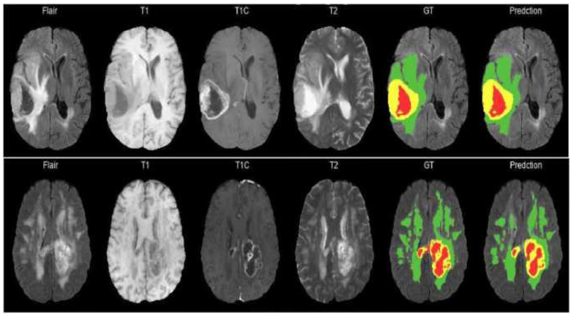 Electronics 10 01962 g005