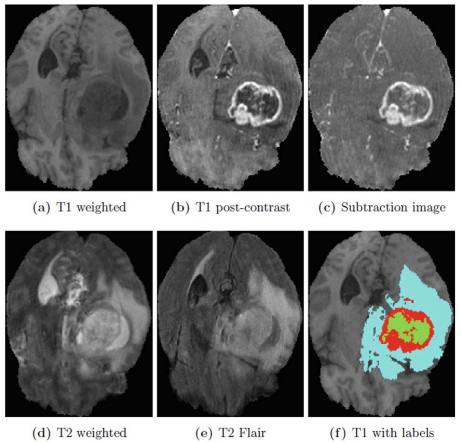 Electronics 10 01962 g006