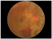 Electronics 11 00023 i003