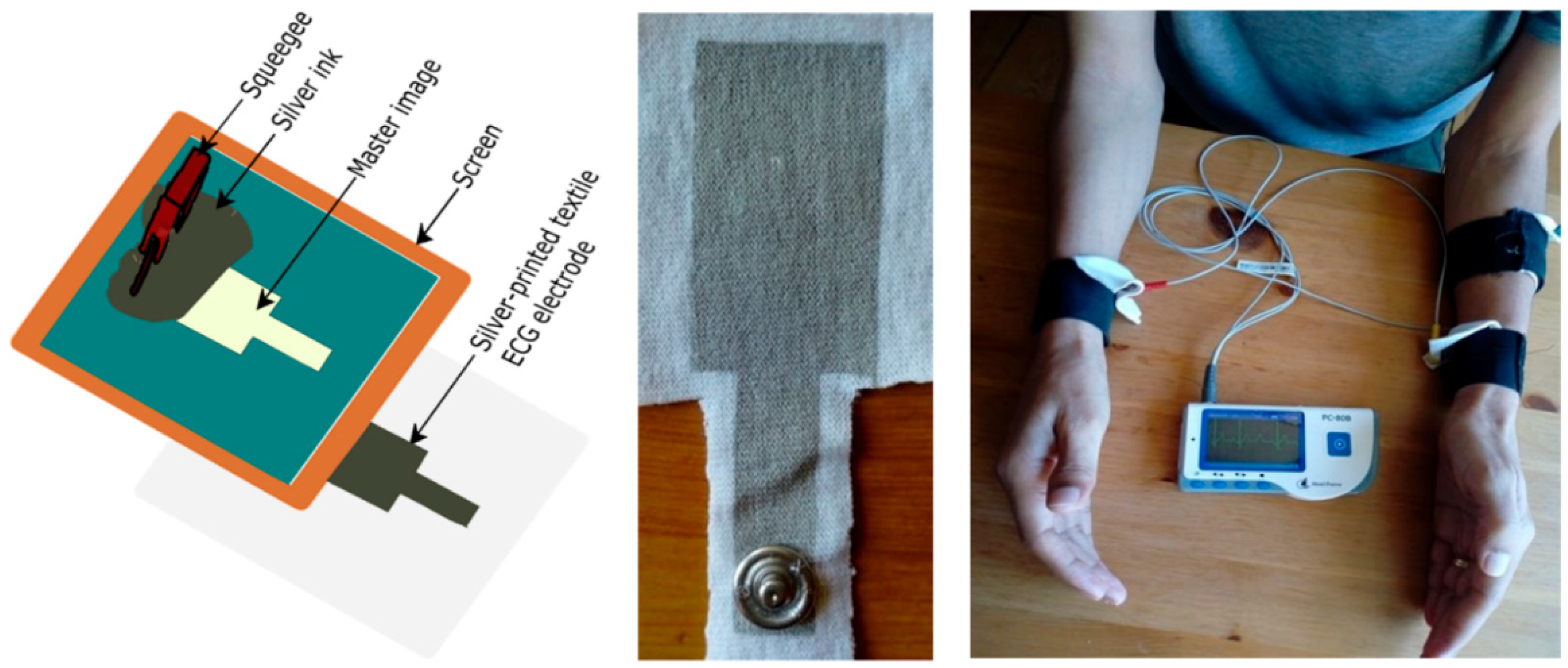 Electronics 11 00099 g012