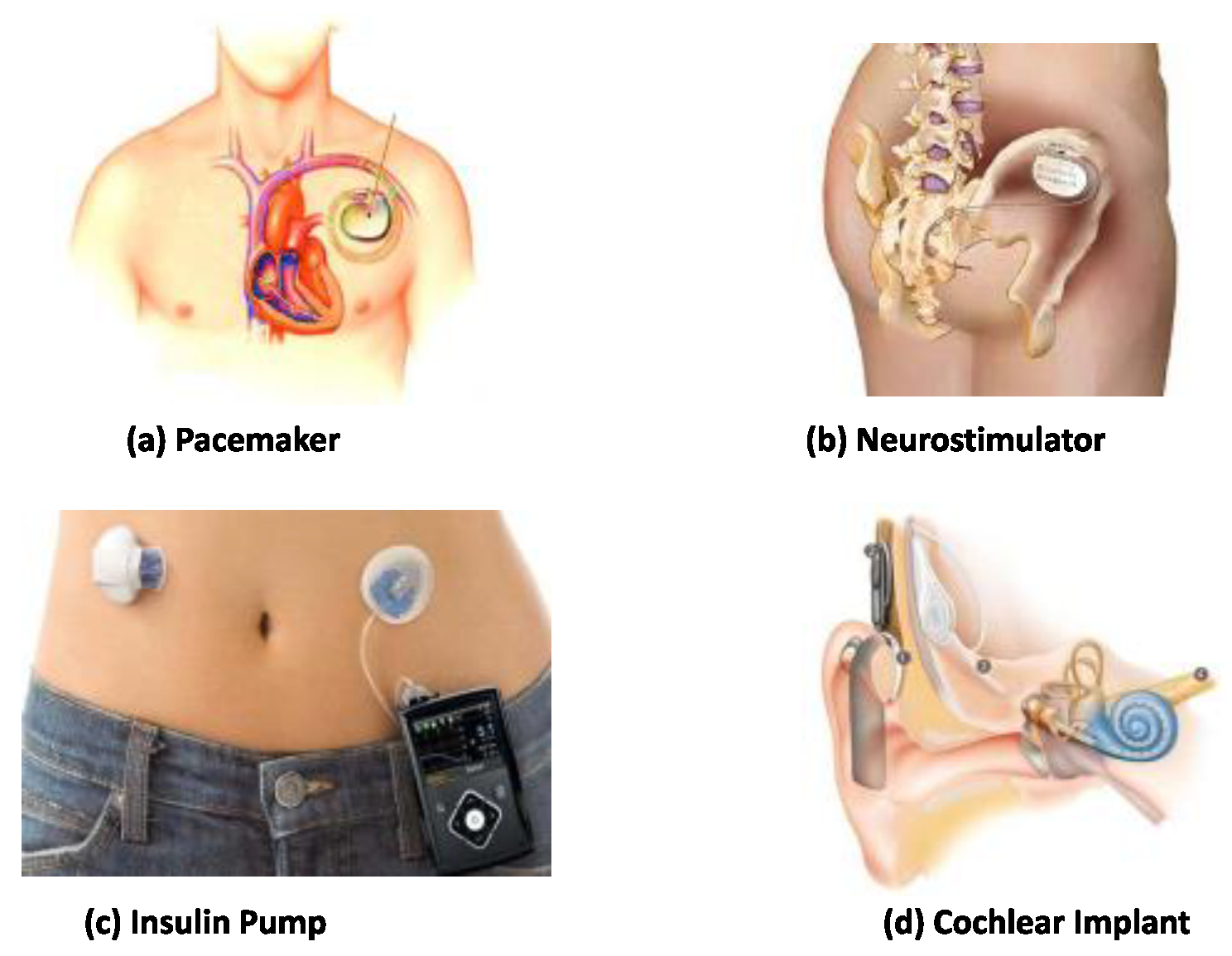 Electronics 11 00610 g011