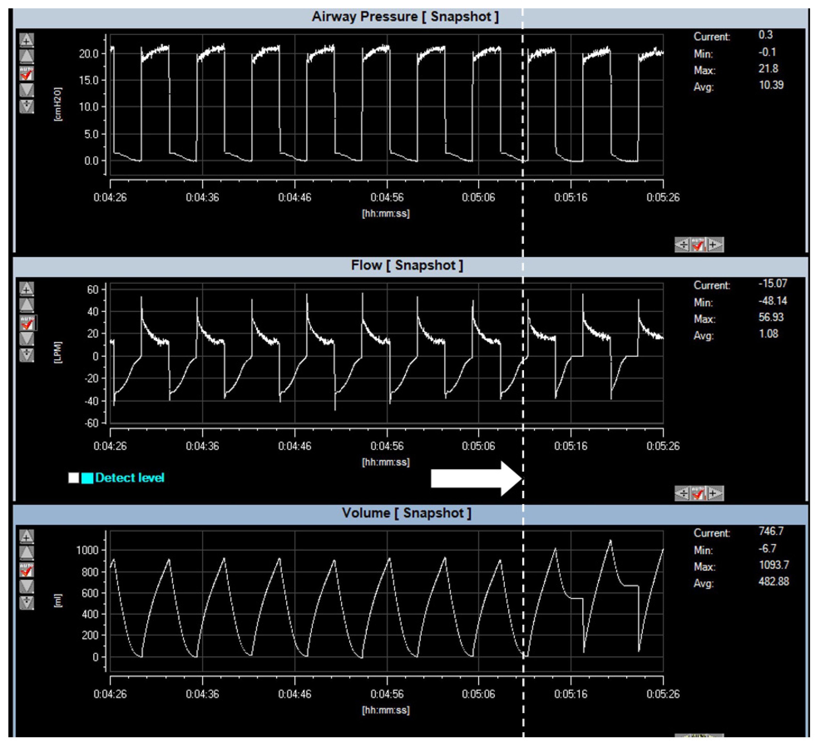 Electronics 11 00753 g021
