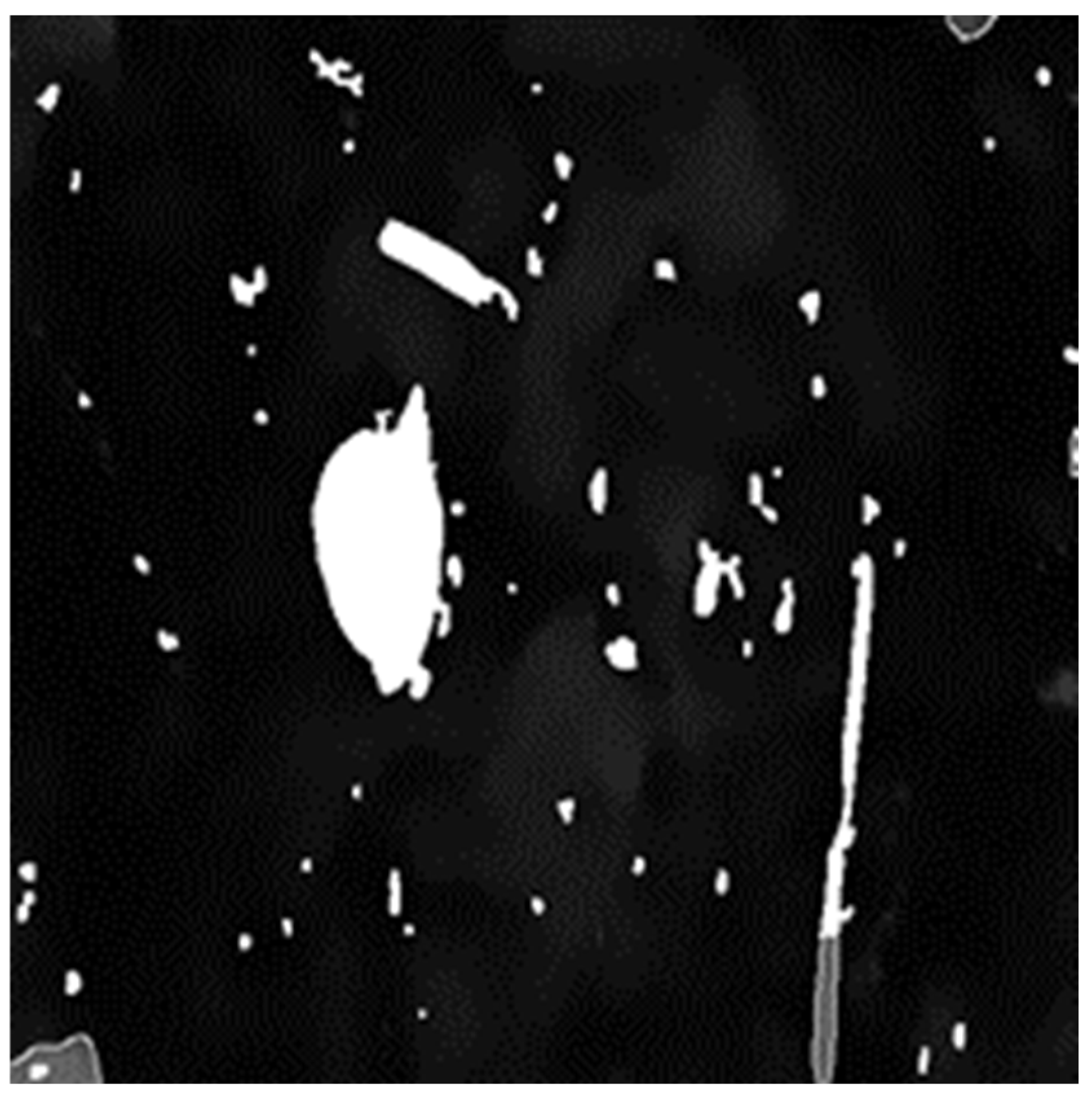 Electronics 11 00974 g011