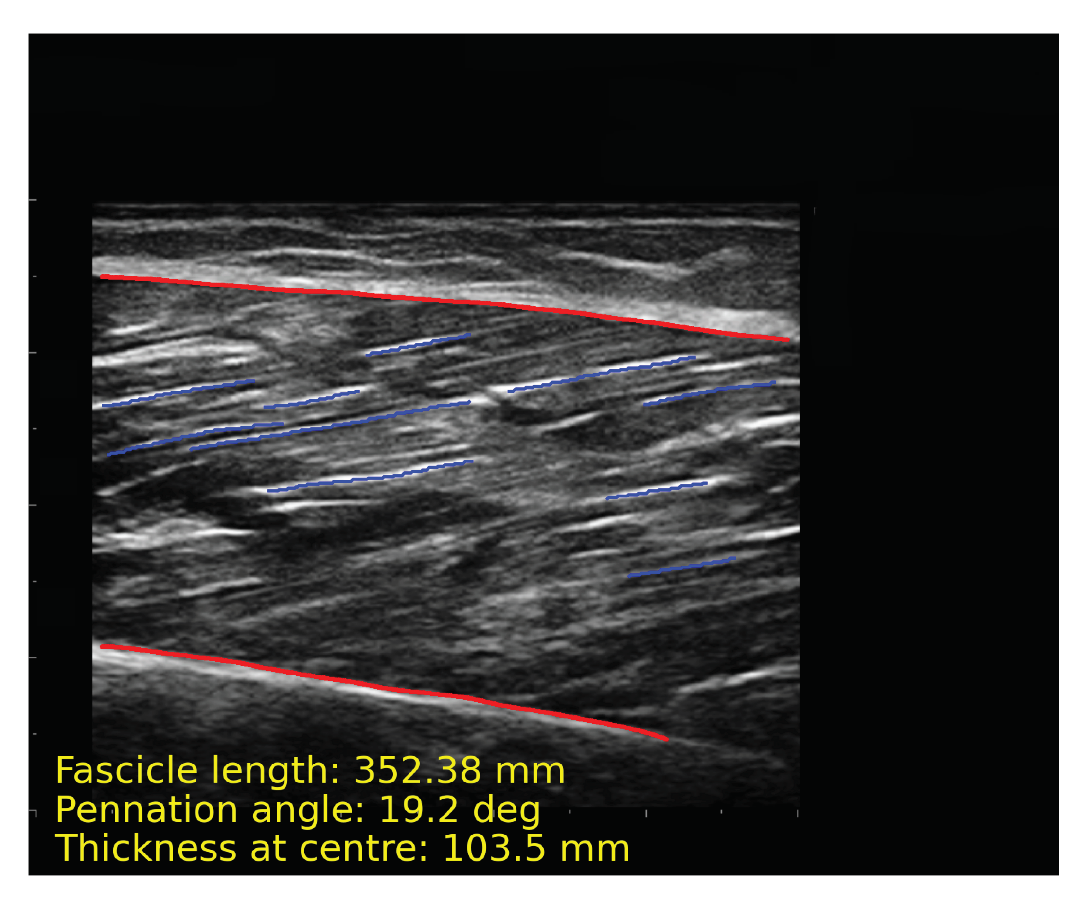 Electronics 11 01093 g008 Electronics 11 01093 g008
