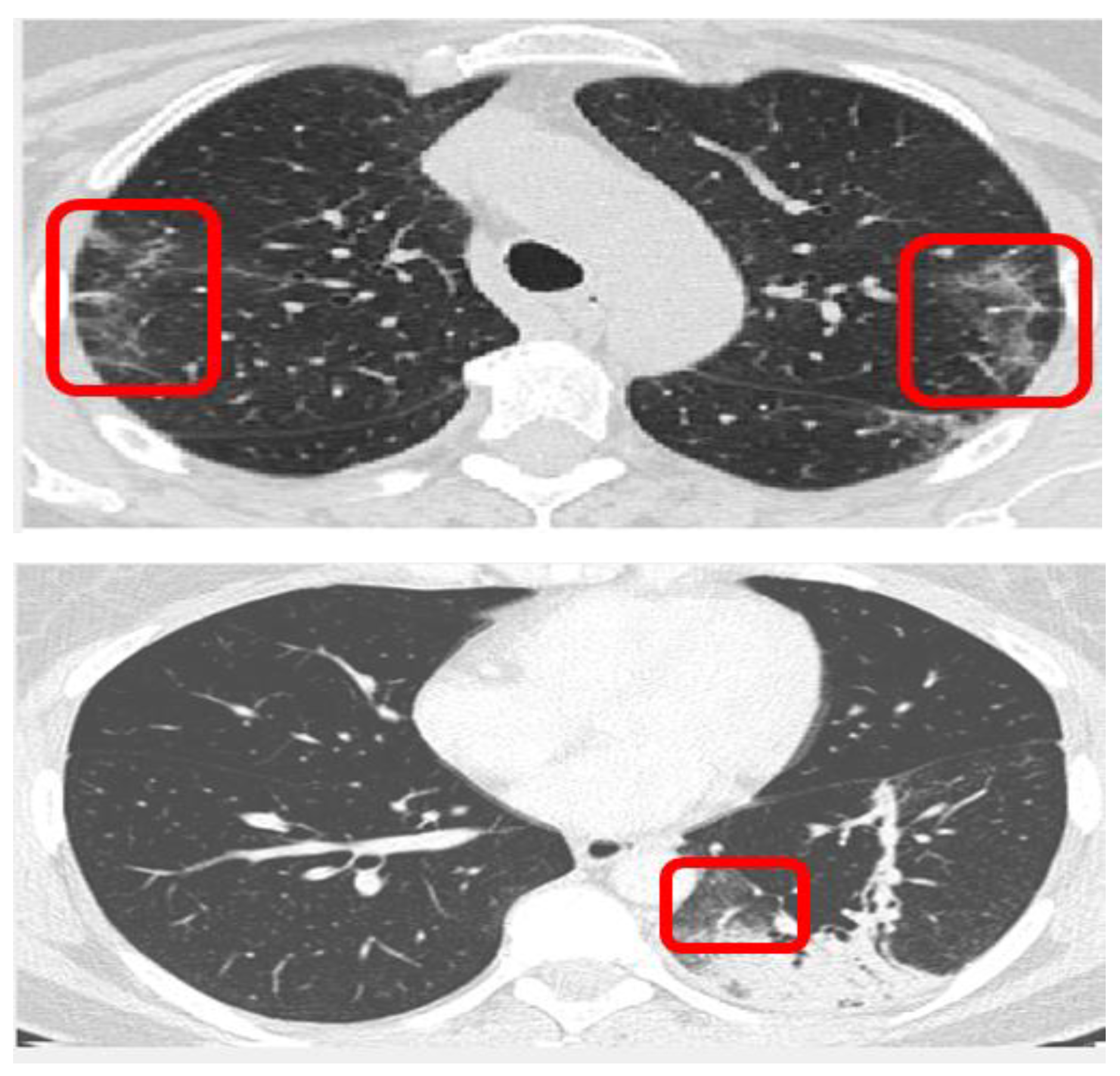 Electronics 11 01148 g001