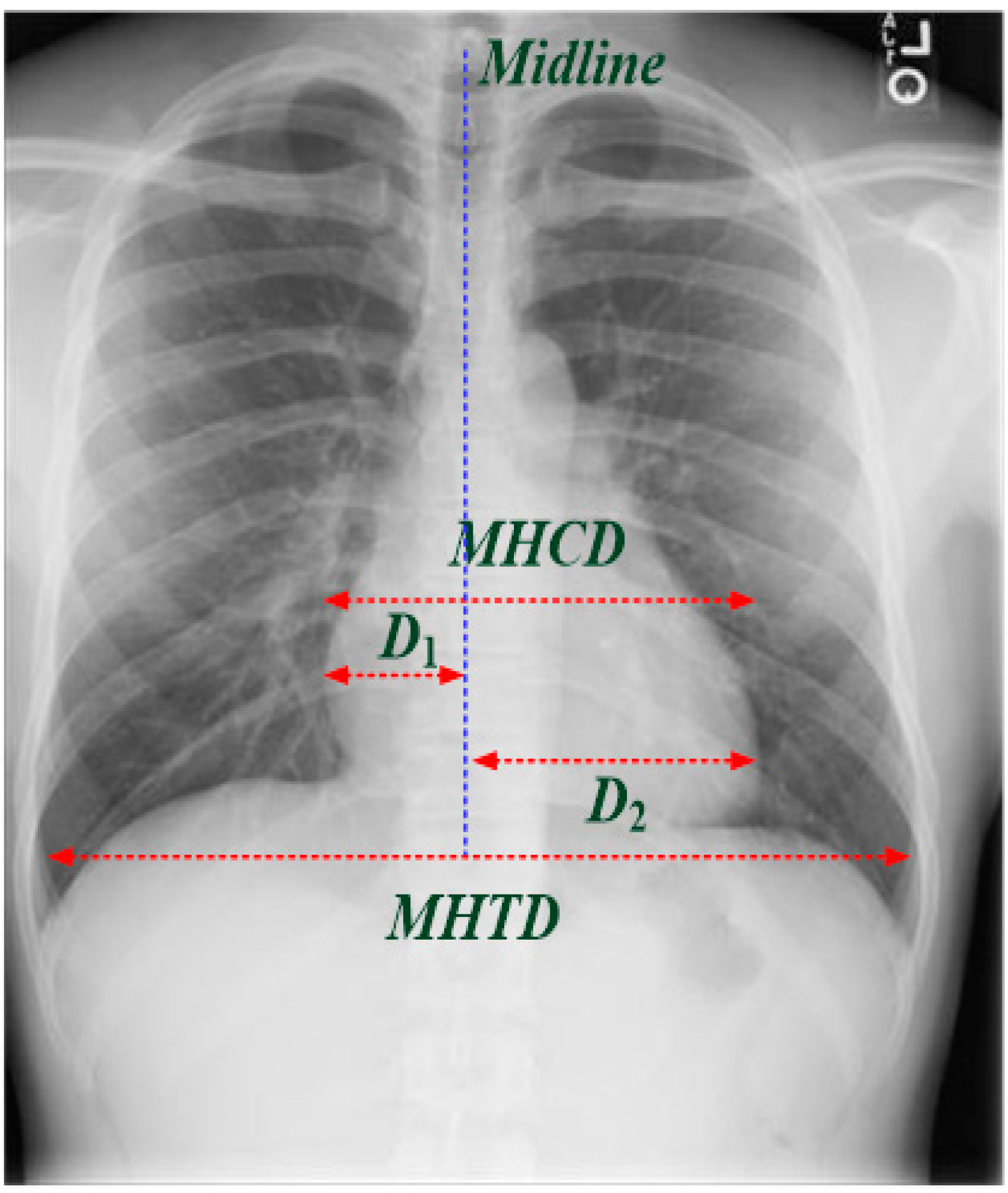 Electronics 11 01364 g001