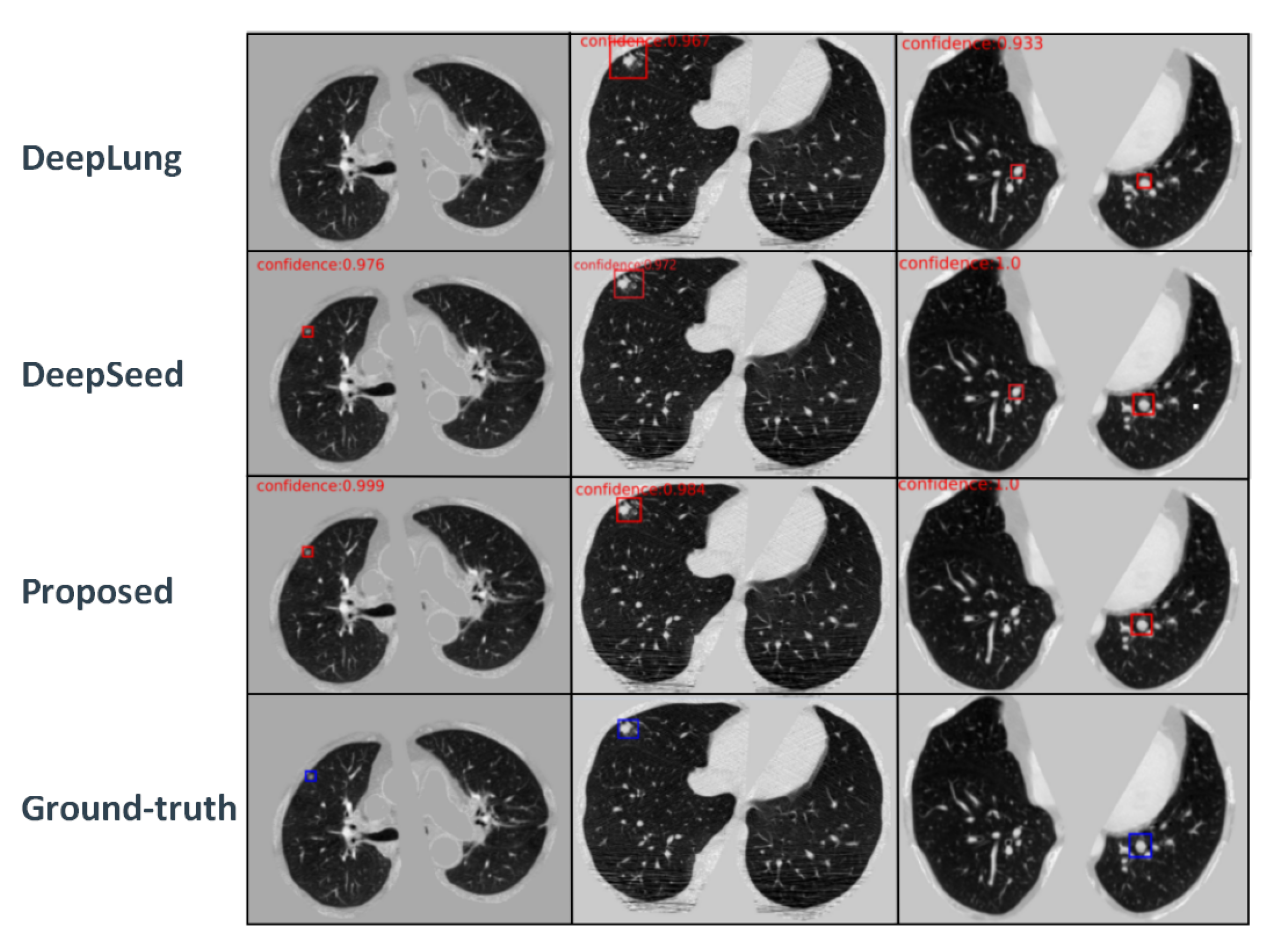 Electronics 11 01600 g006
