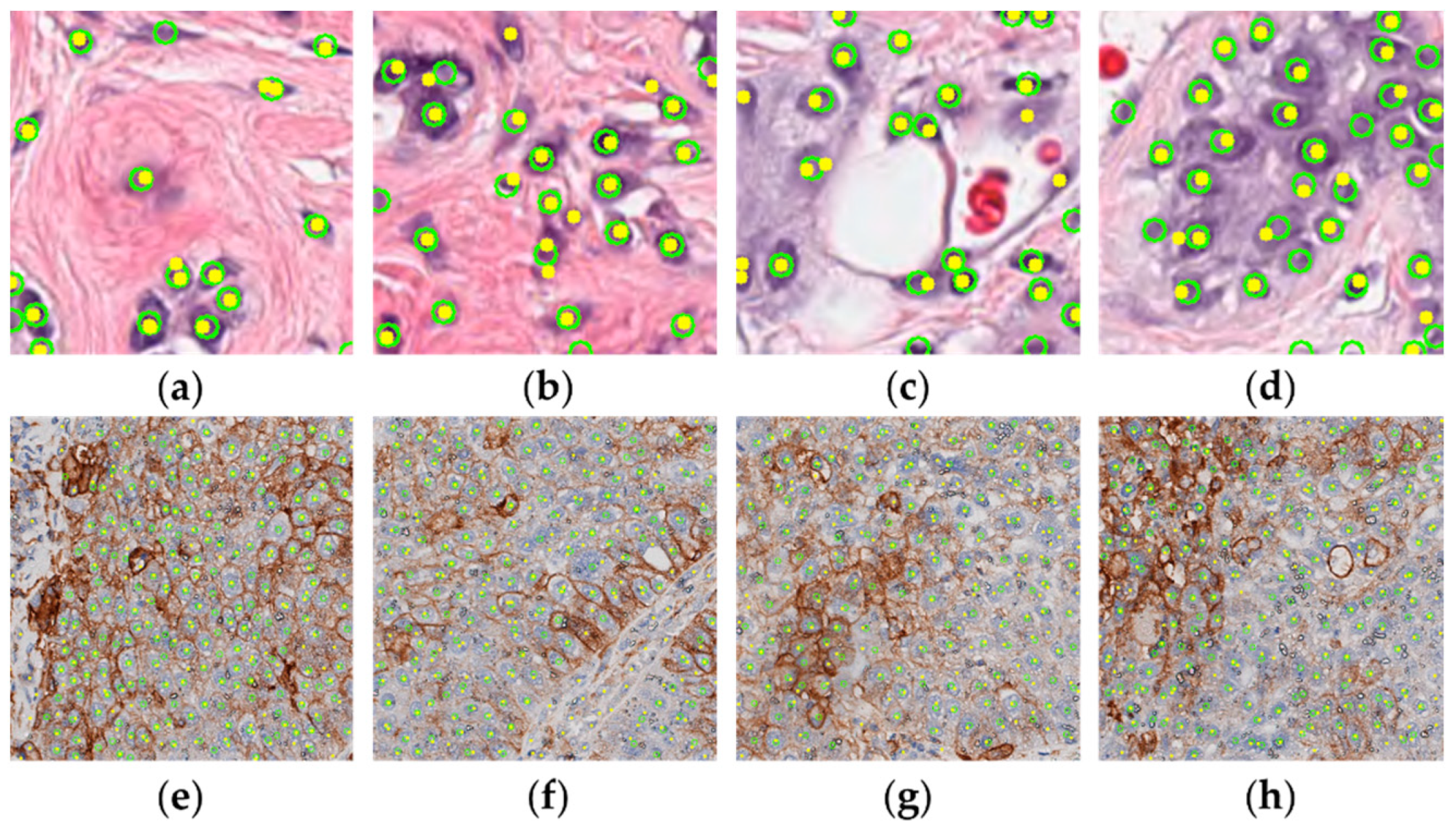 Electronics 11 01642 g008