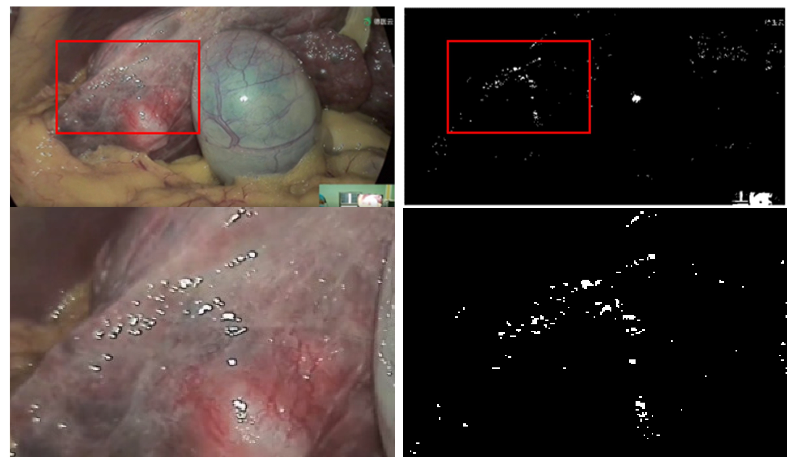 Electronics 11 01909 g006