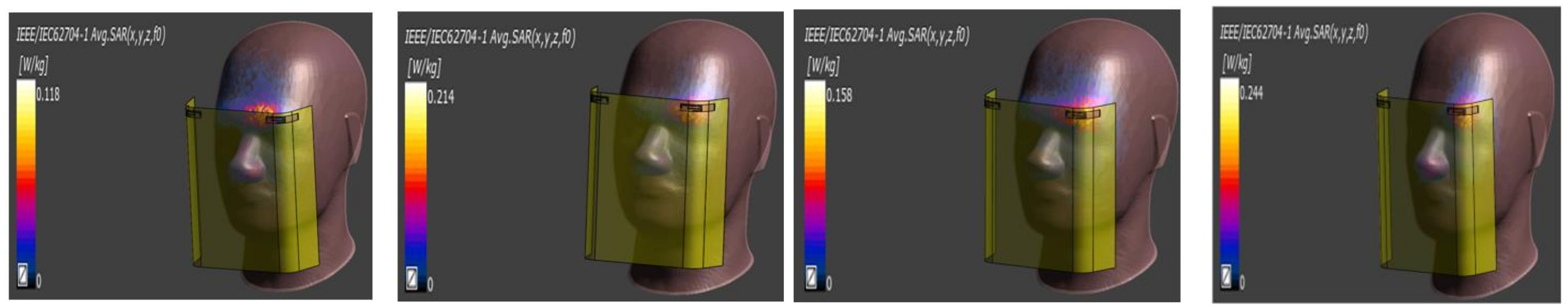 Electronics 11 01983 g038