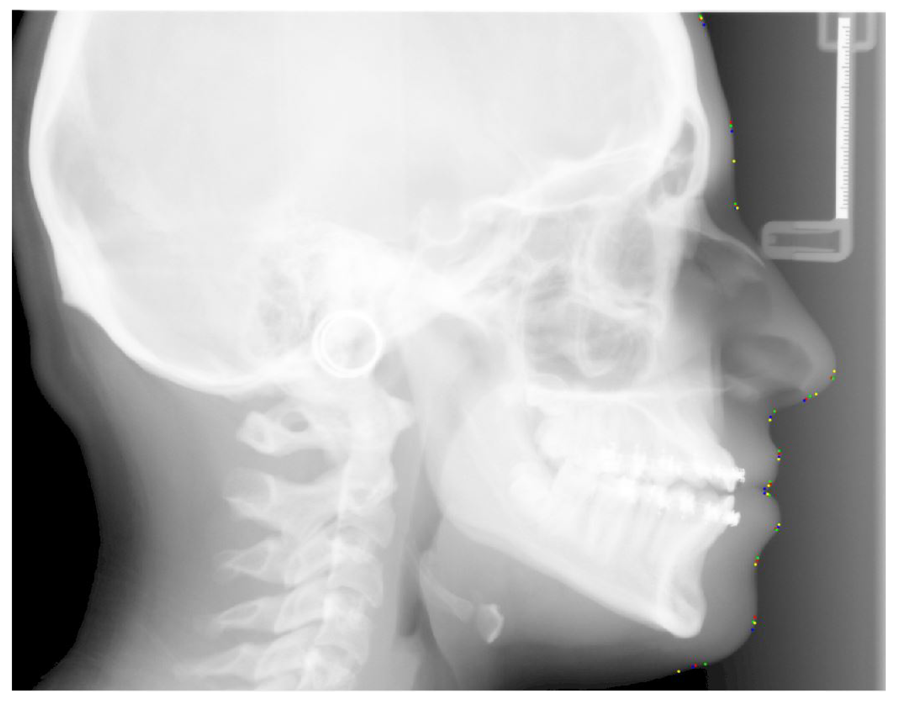 Electronics 11 02408 g006