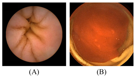 Electronics 11 02747 g0a2 550