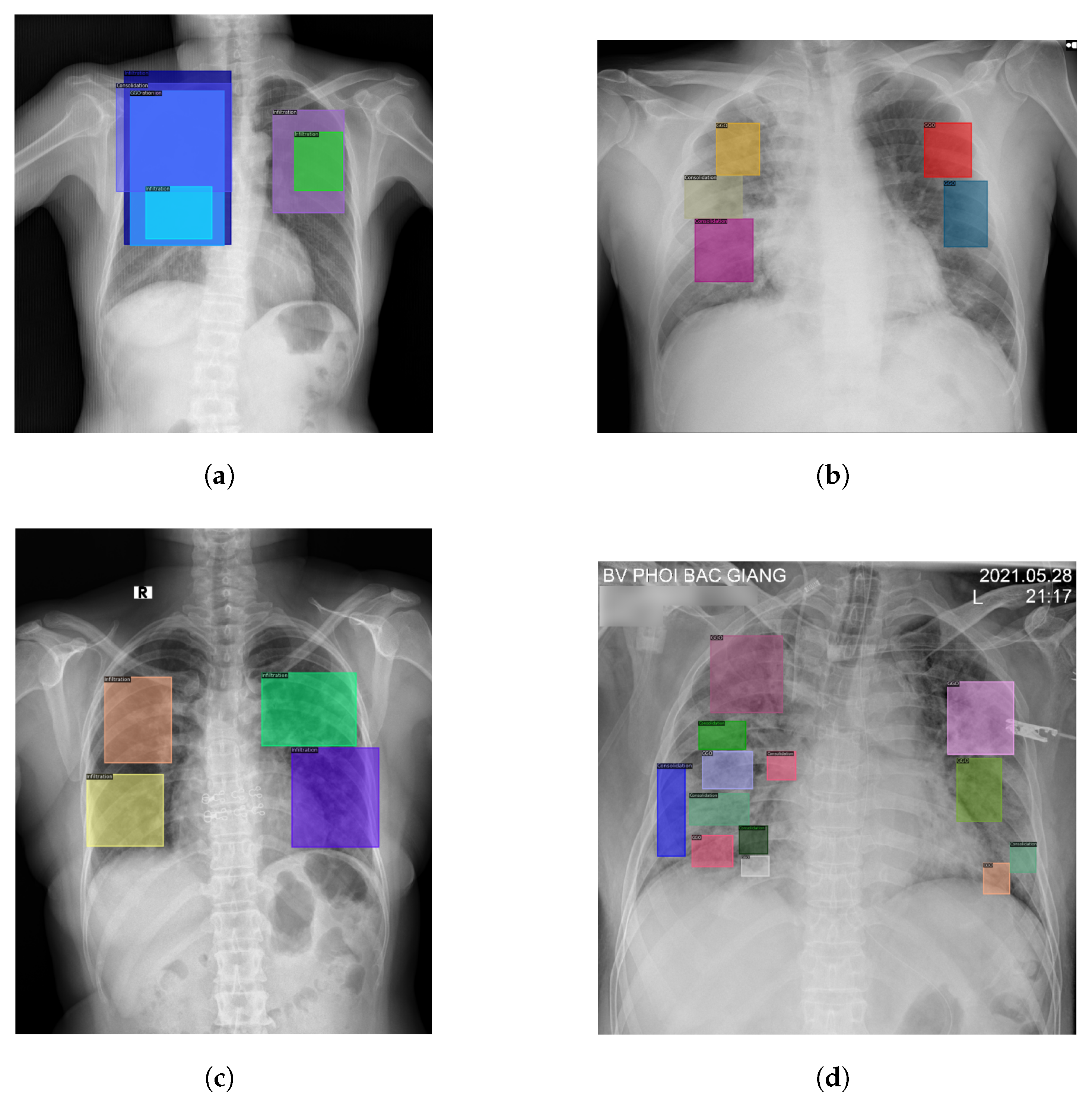Electronics 11 02893 g013