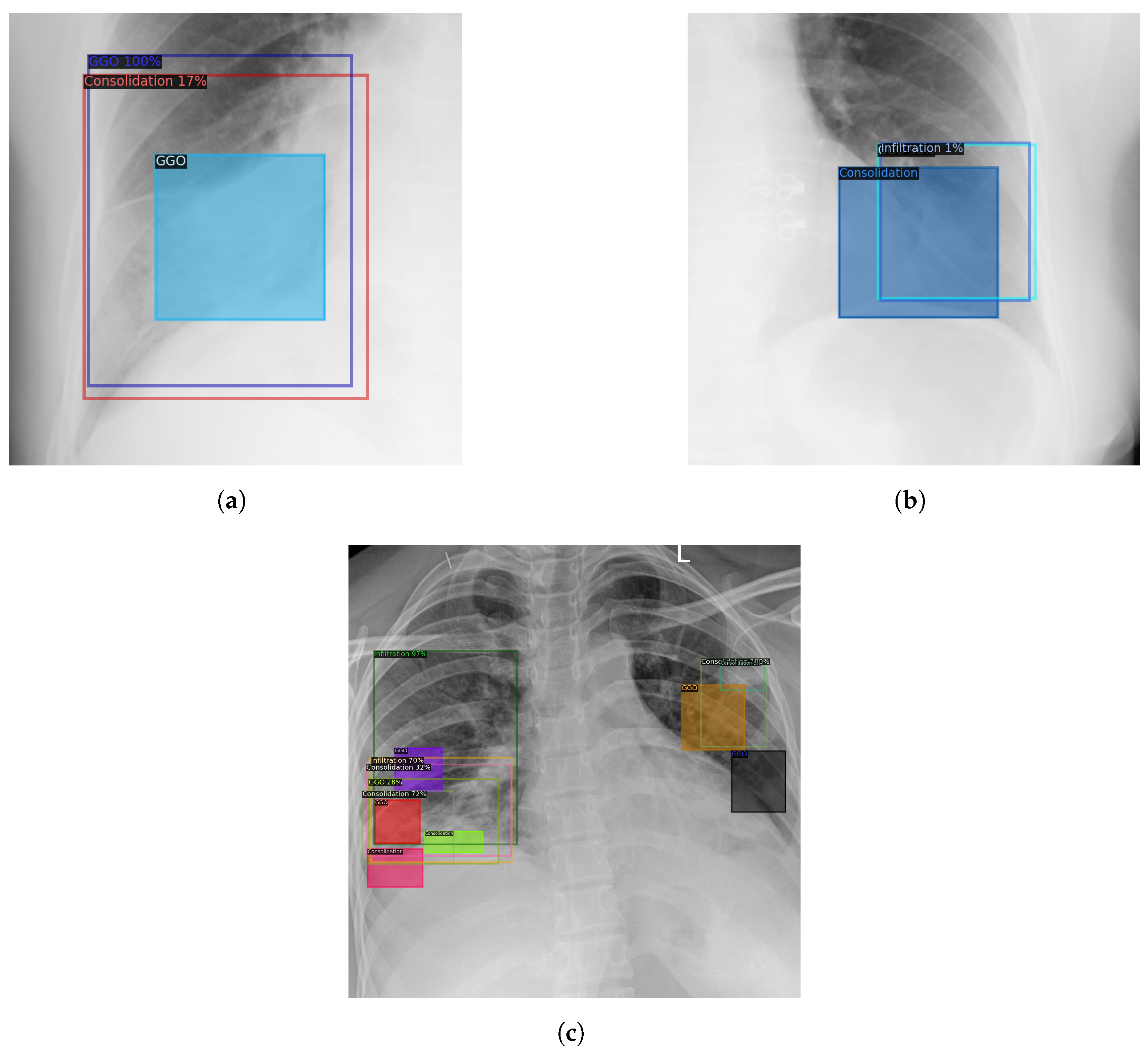 Electronics 11 02893 g015