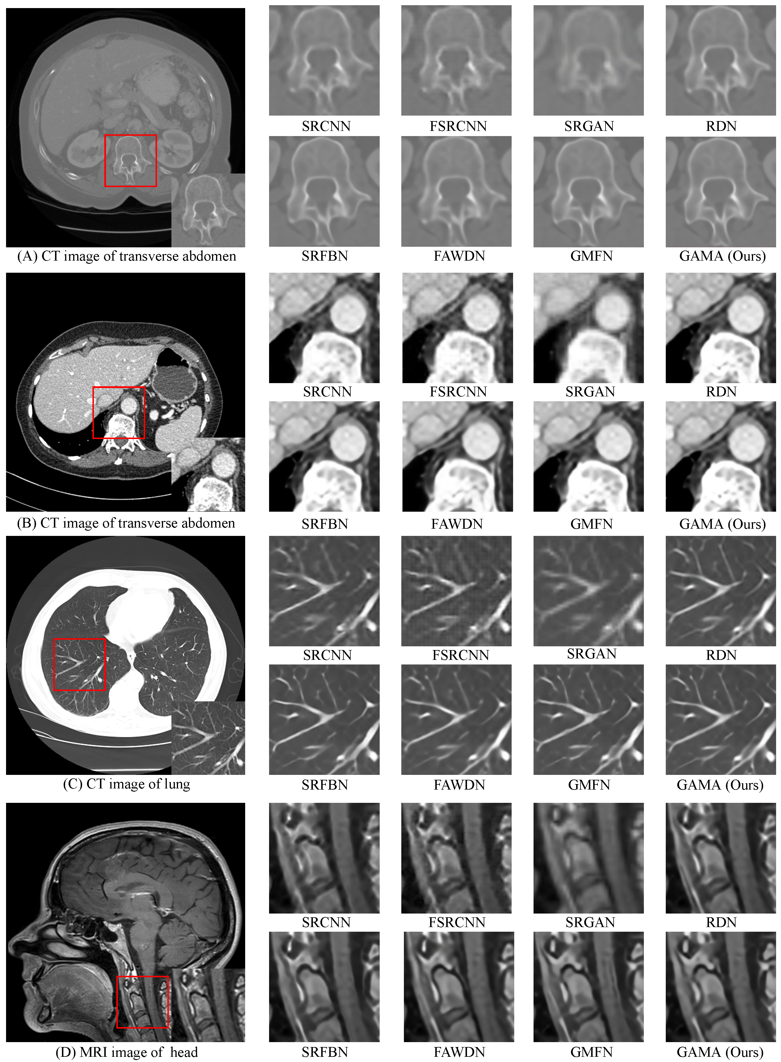 Electronics 11 03554 g005 Electronics 11 03554 g005