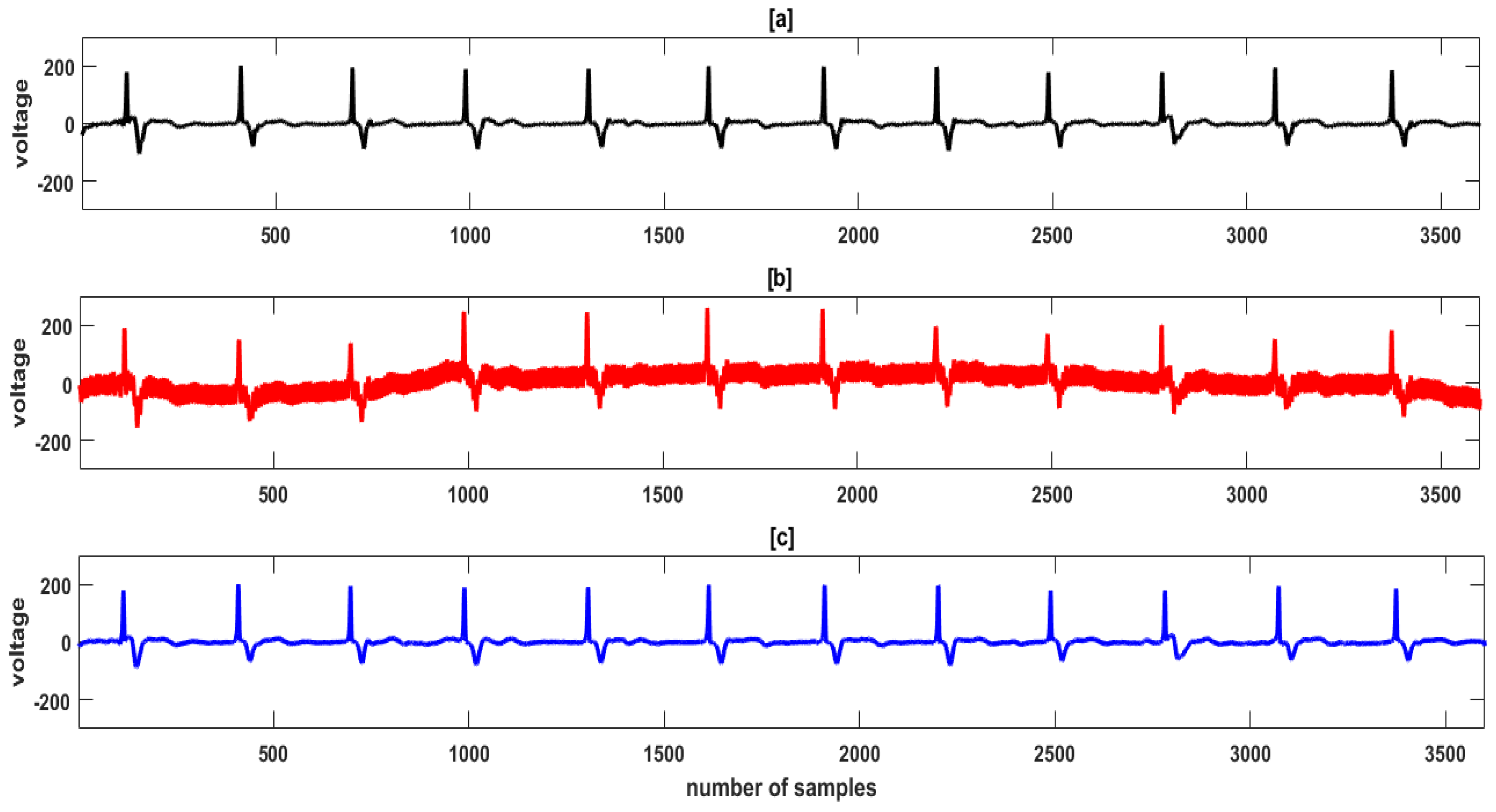 Electronics 12 00387 g007