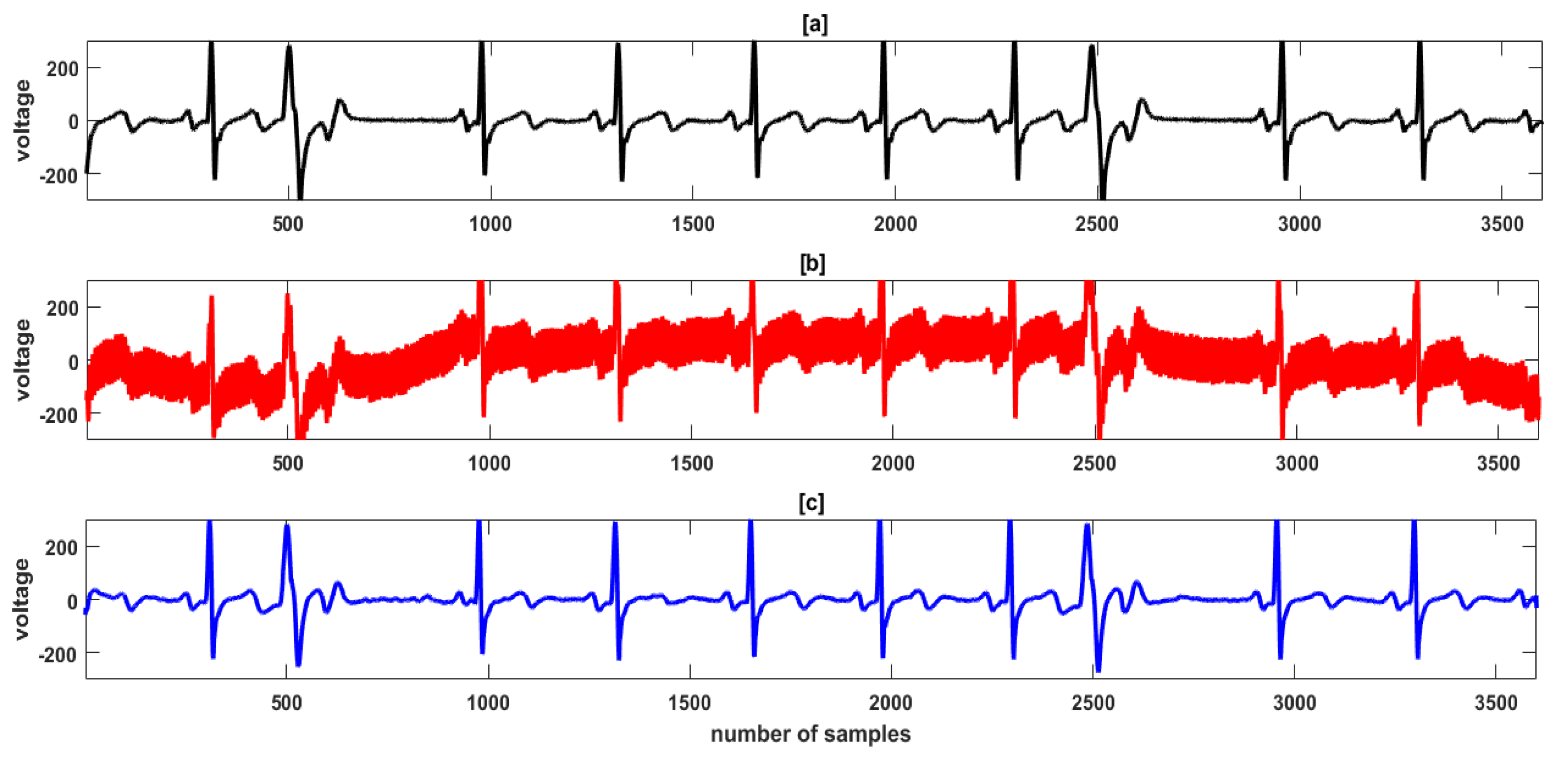 Electronics 12 00387 g008