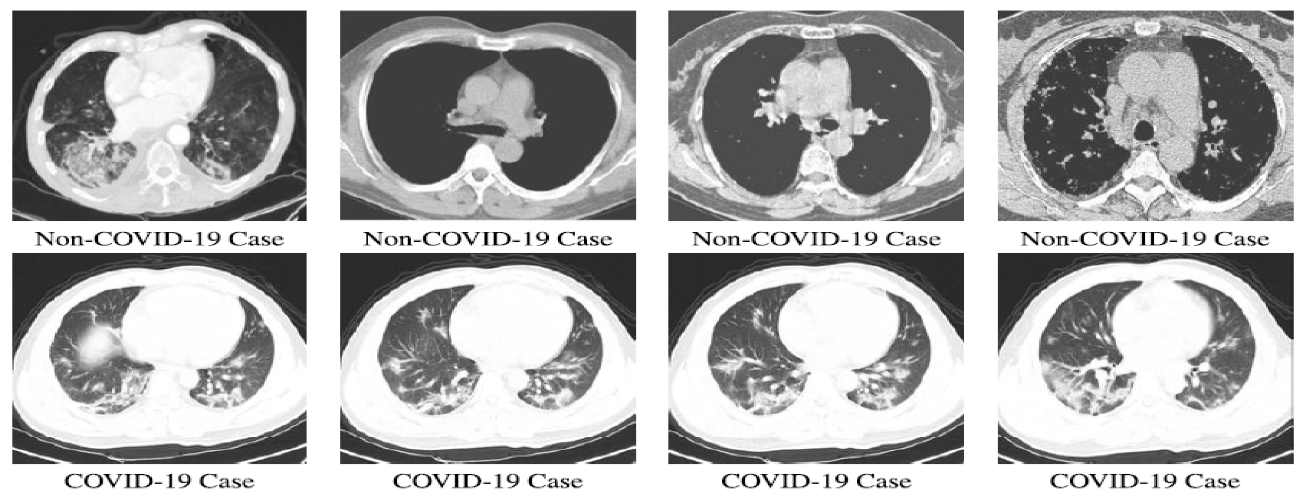Electronics 12 00424 g006