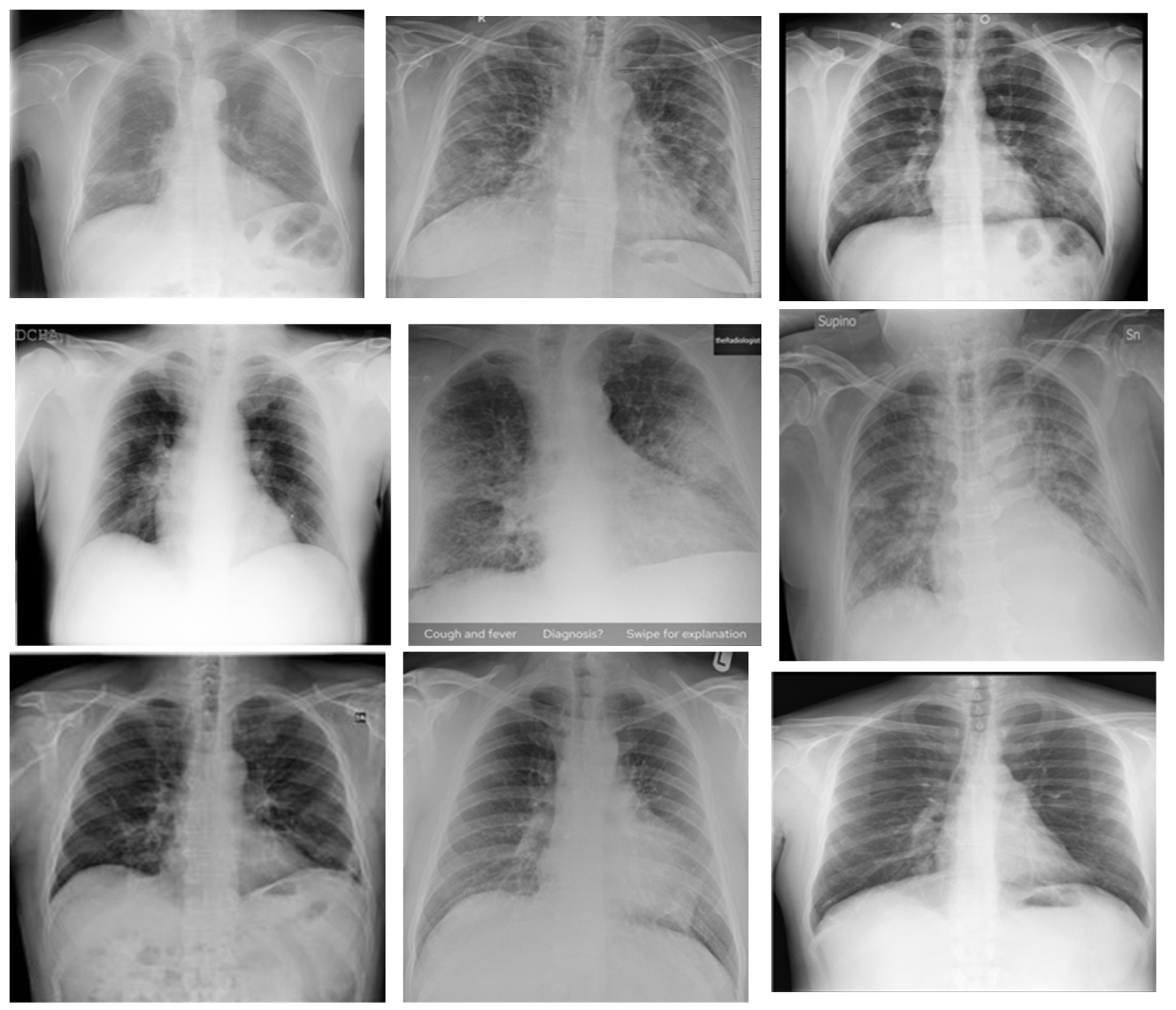 Electronics 12 00424 g007