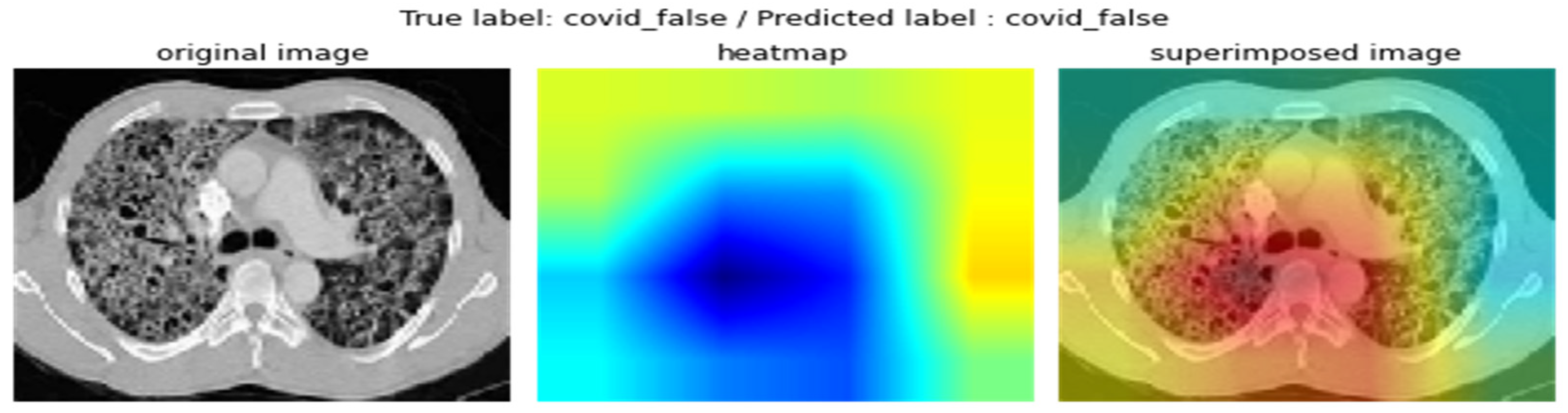 Electronics 12 00424 g010
