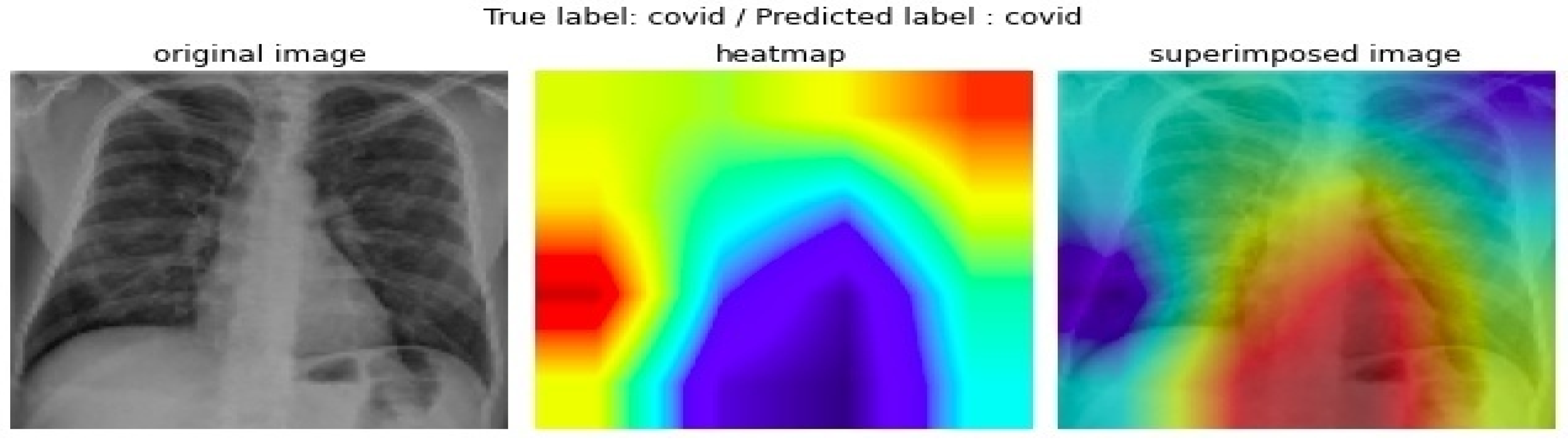 Electronics 12 00424 g011