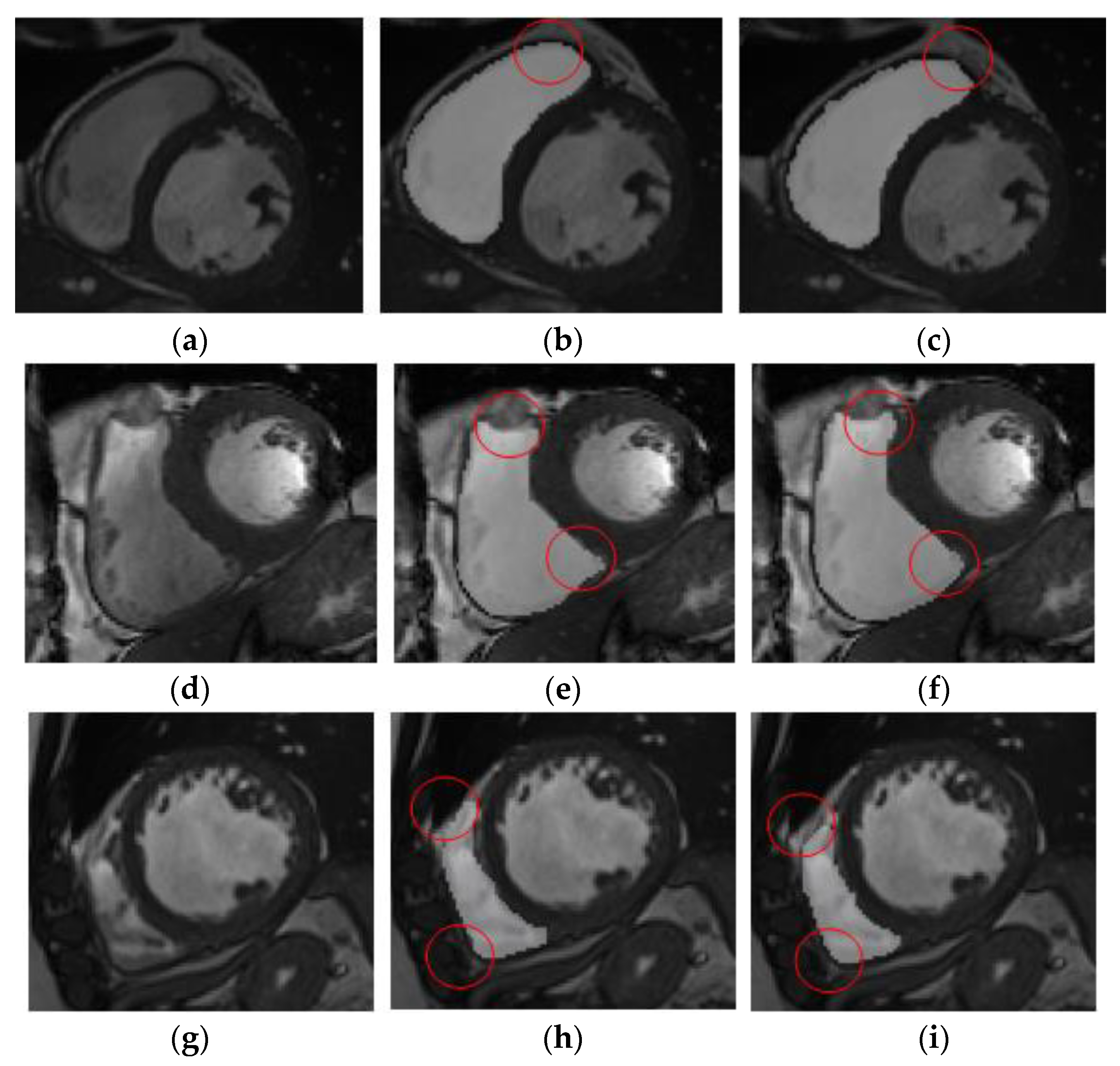 Electronics 12 00466 g005