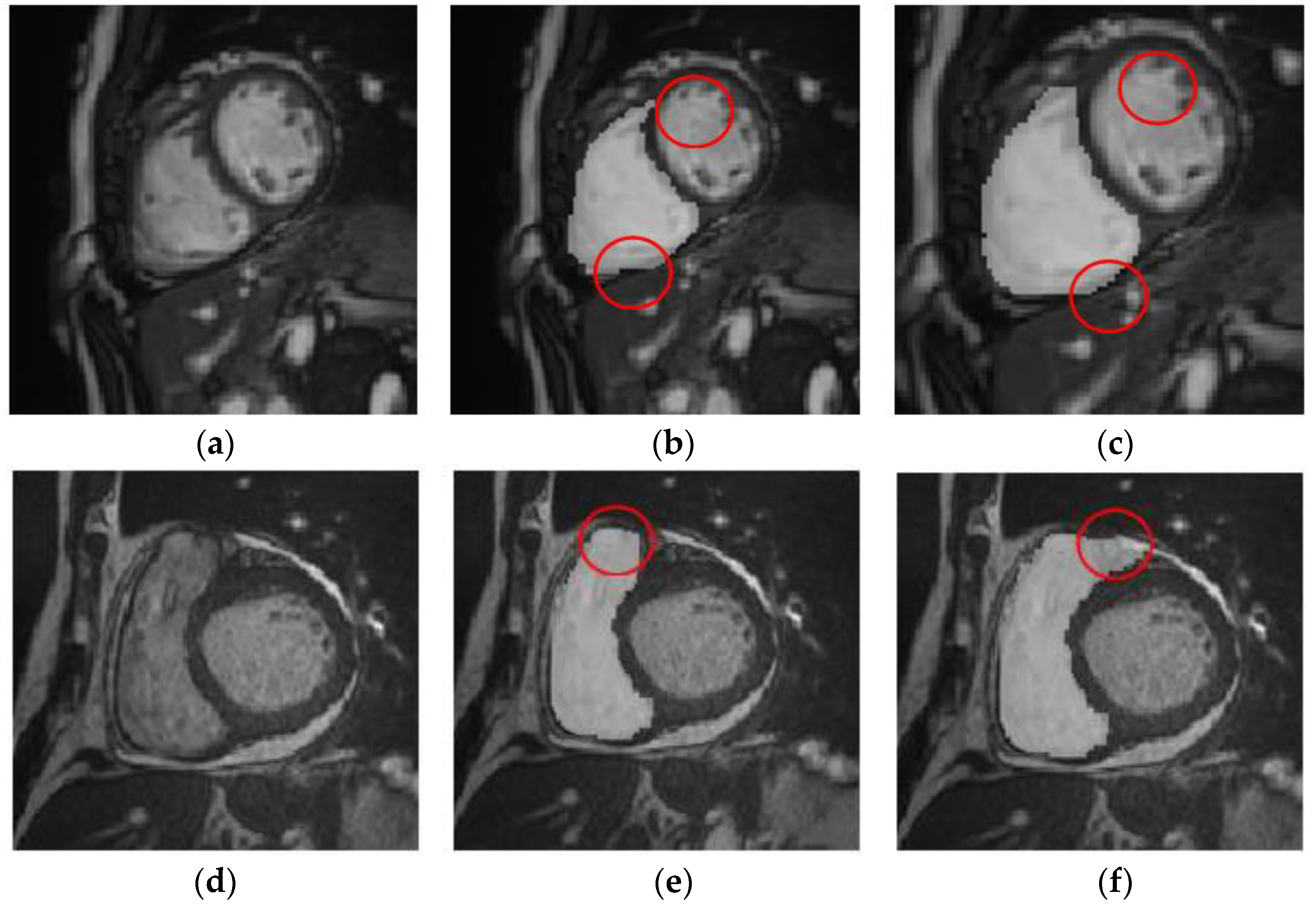 Electronics 12 00466 g008