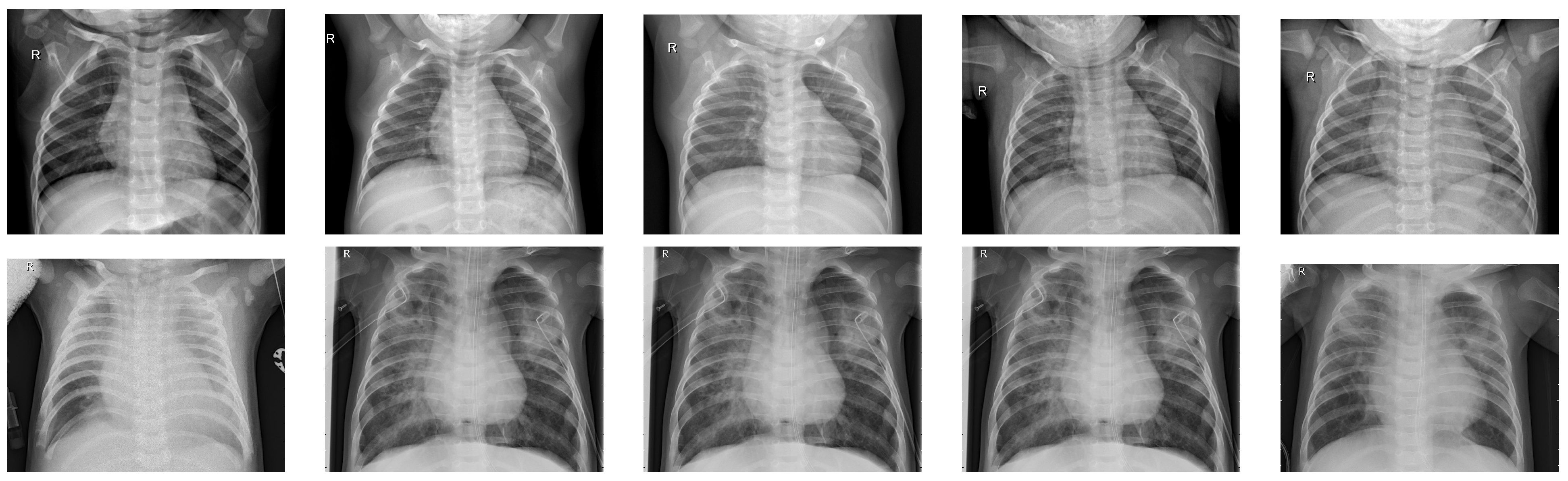 Electronics 12 00710 g005