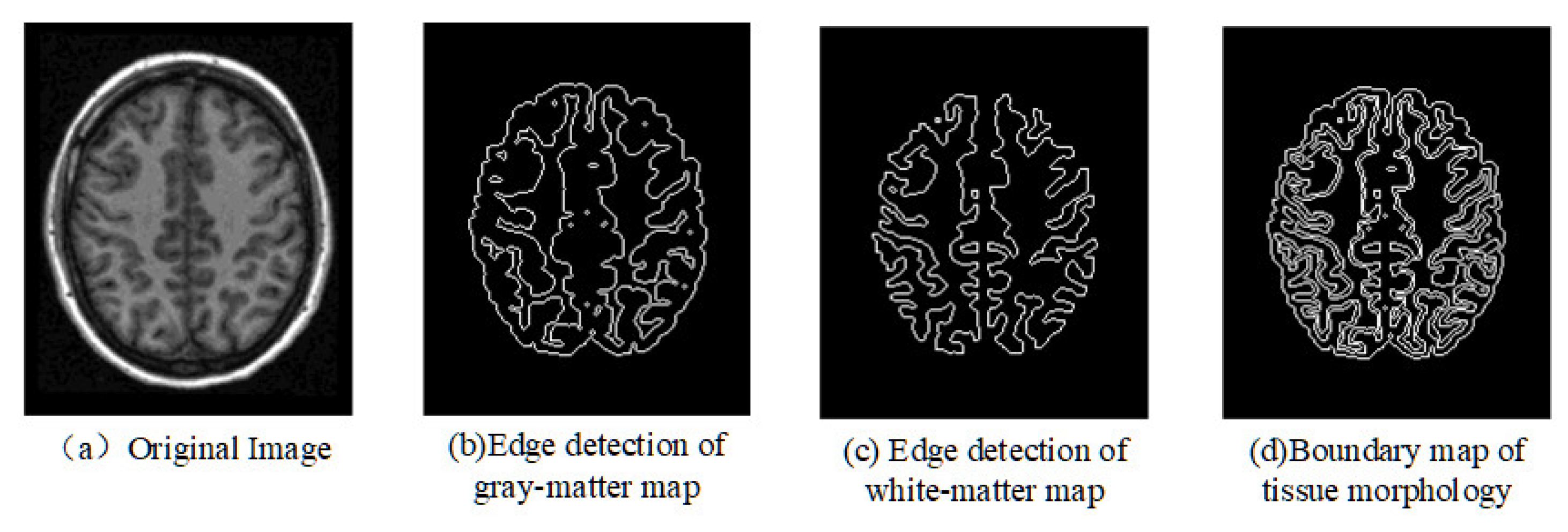 Electronics 12 00738 g003