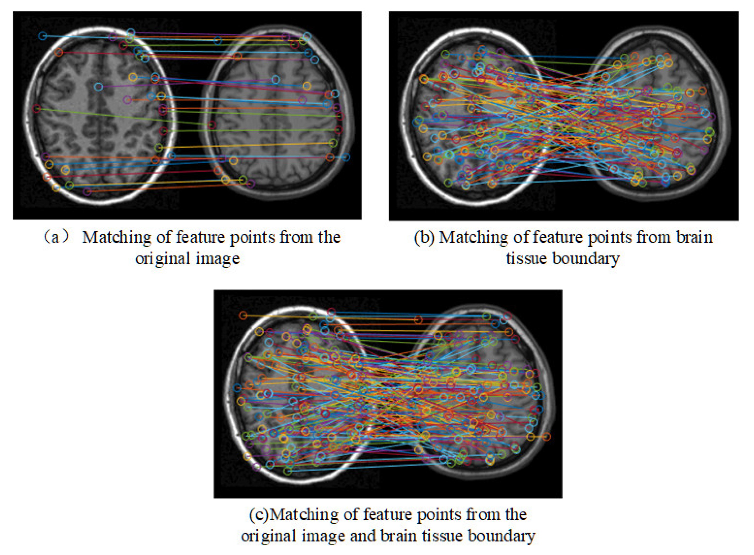 Electronics 12 00738 g004