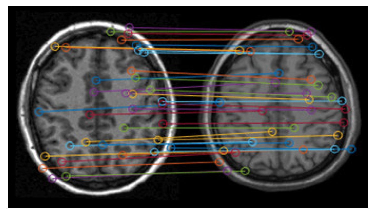Electronics 12 00738 g005