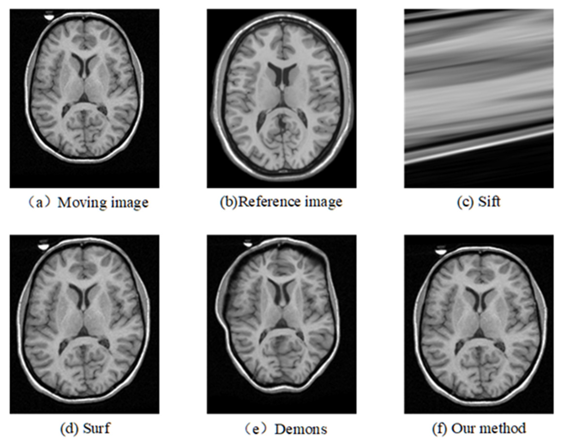 Electronics 12 00738 g006