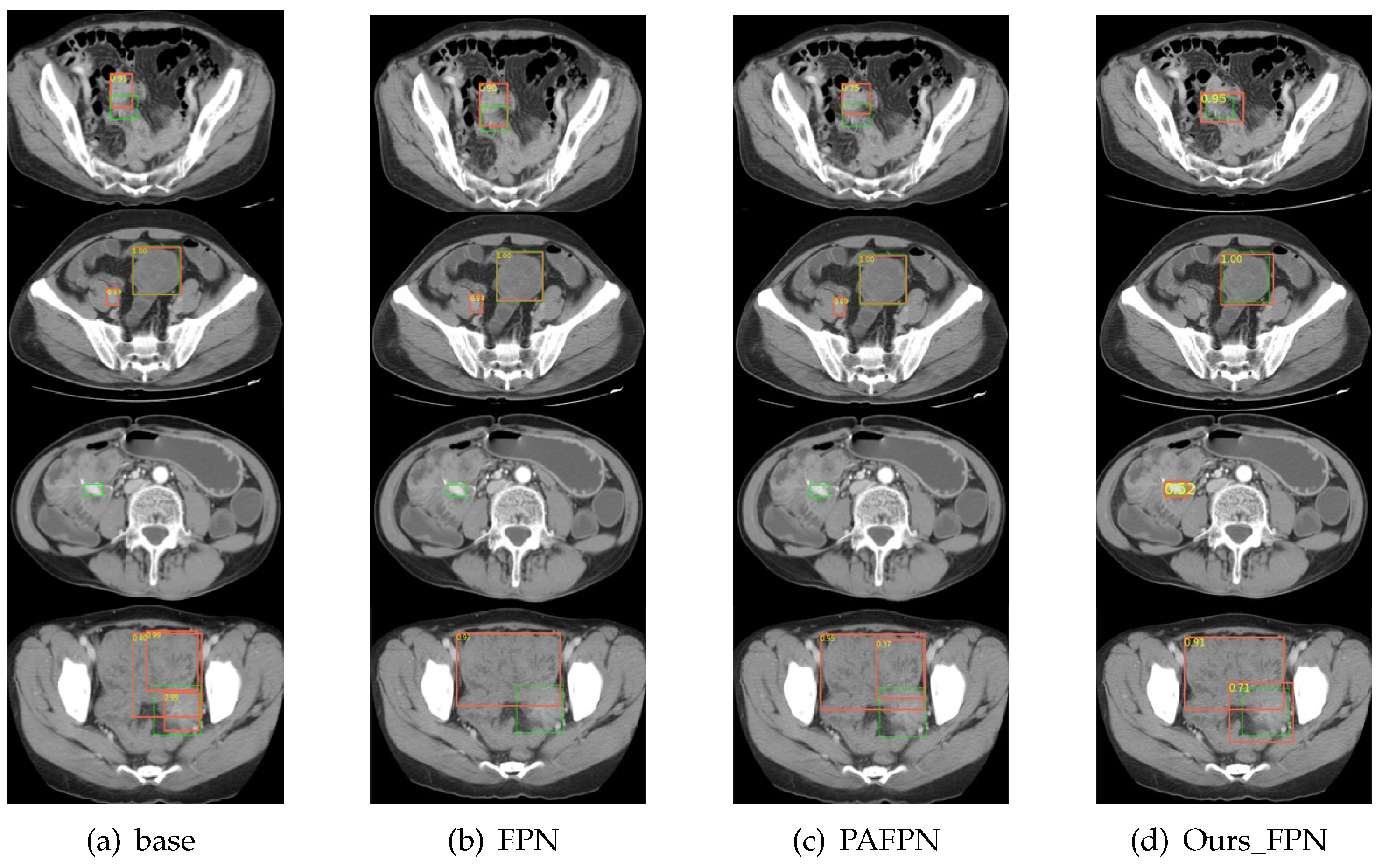 Electronics 12 00904 g004