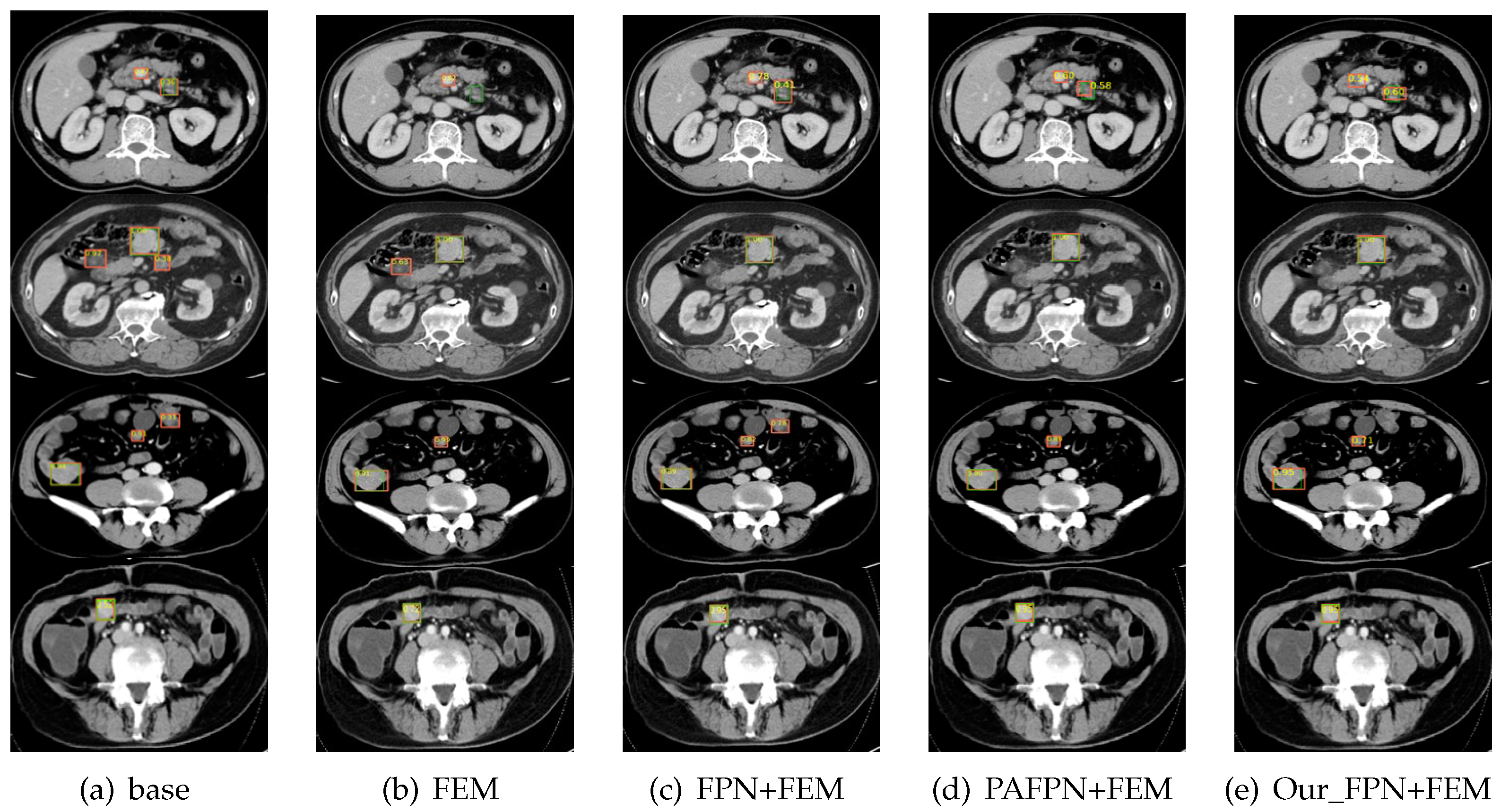 Electronics 12 00904 g005