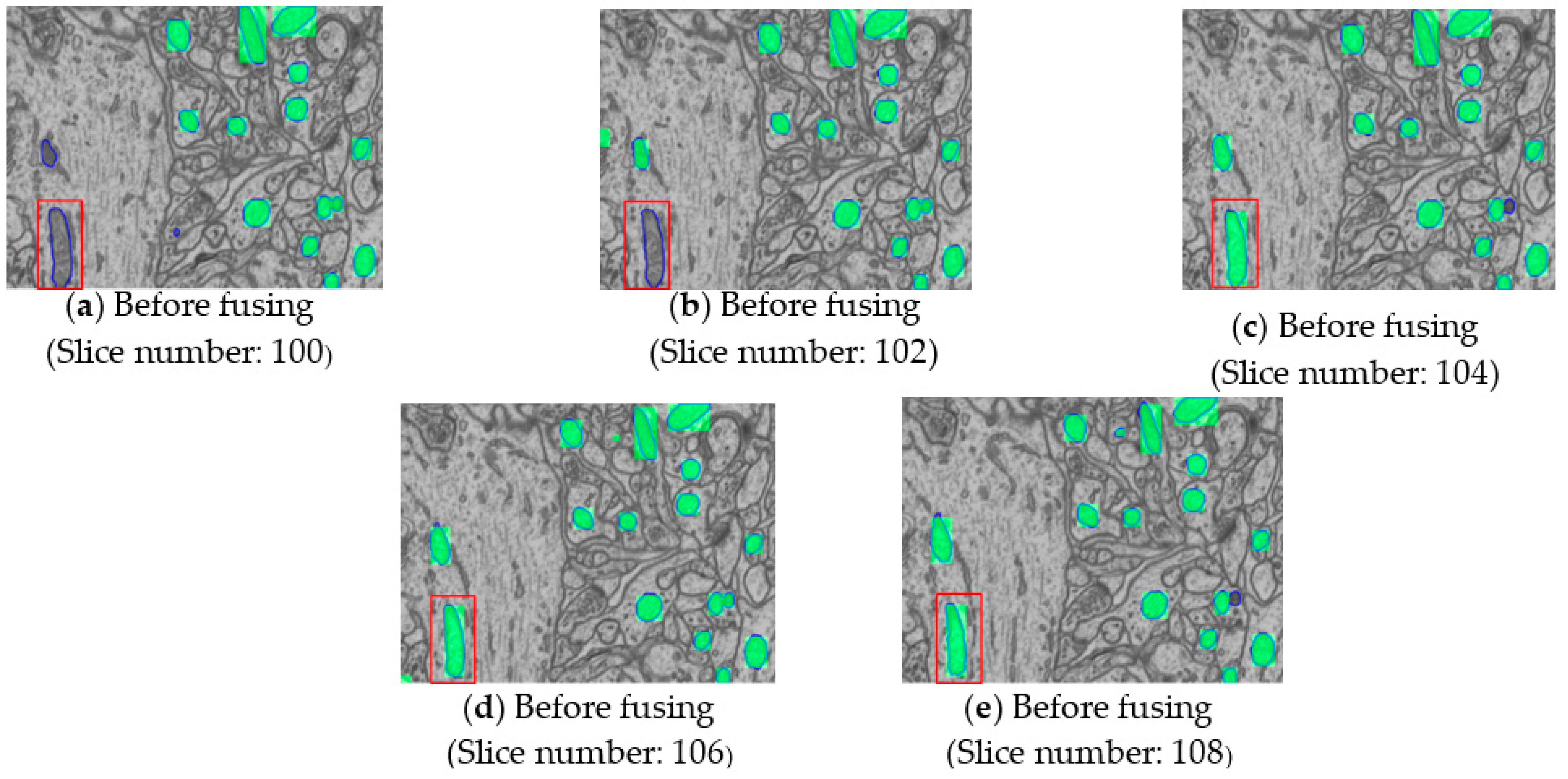 Electronics 12 00928 g011