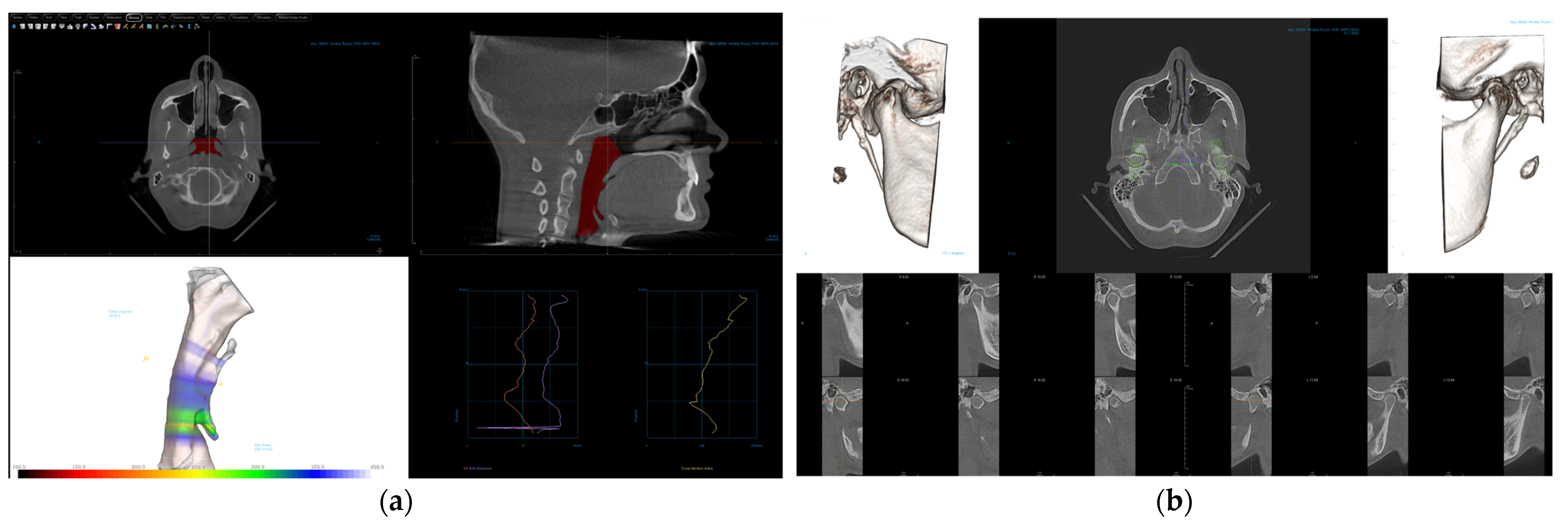 Electronics 12 01710 g003
